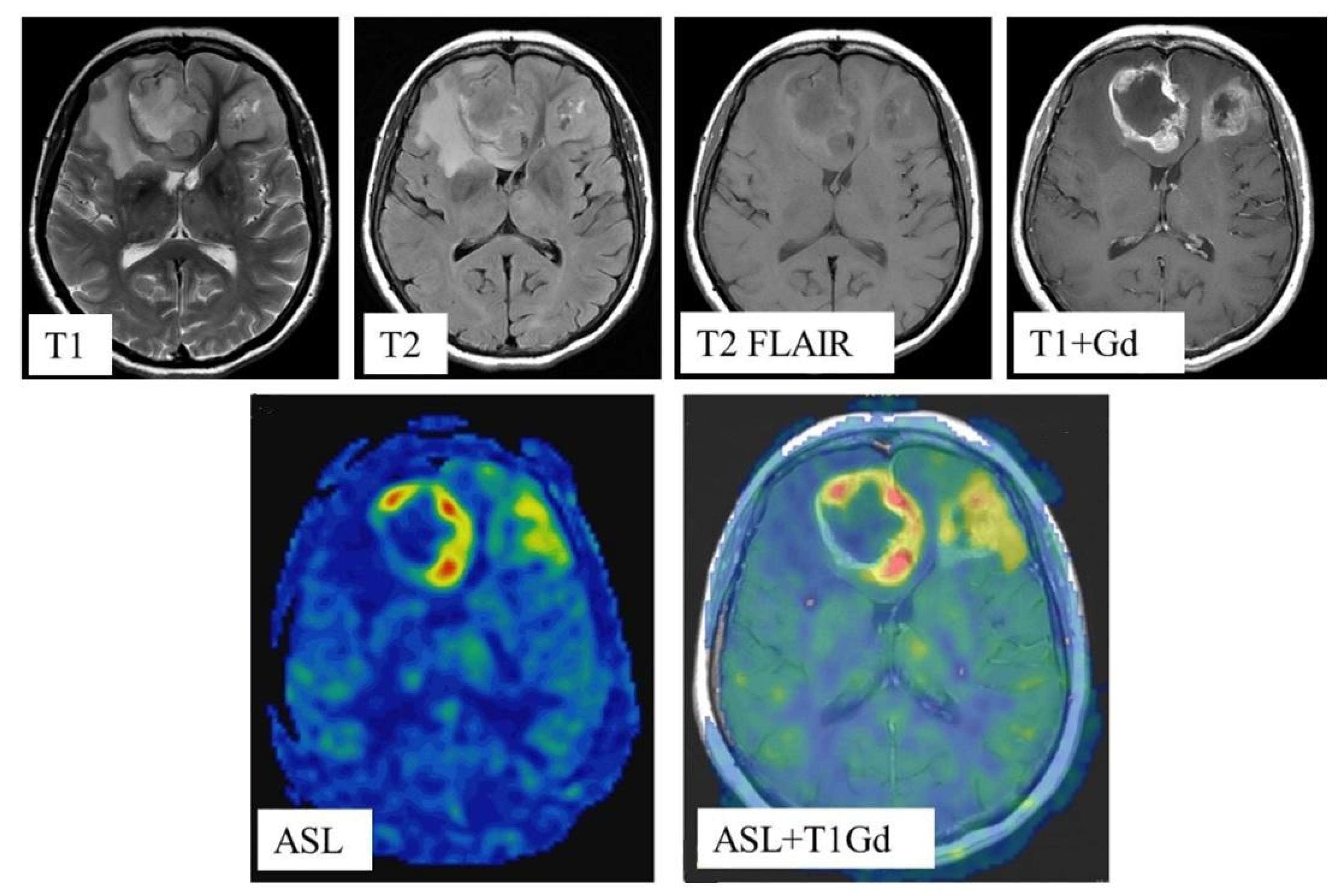 Diagnostics 12 01444 g002 550