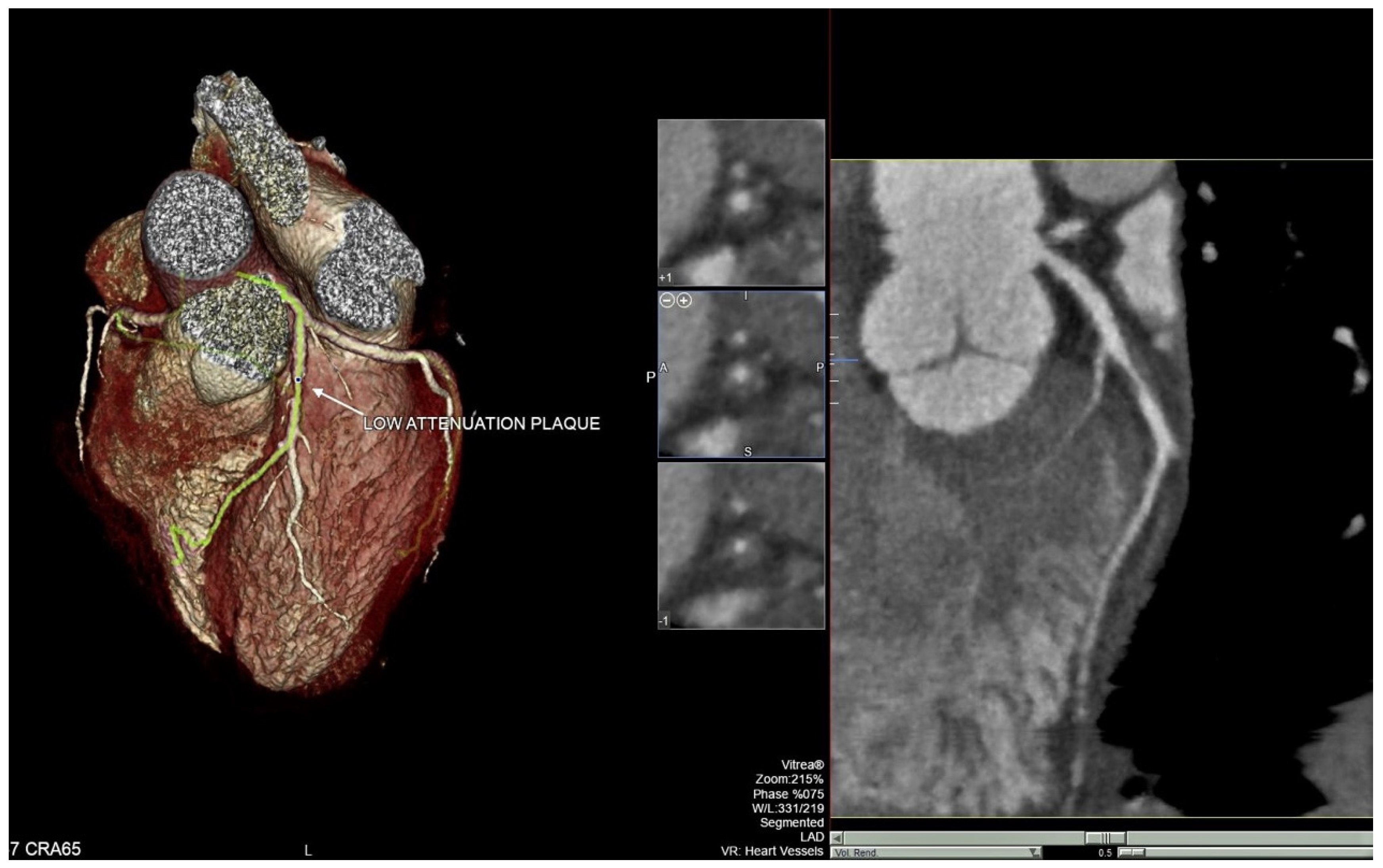 Diagnostics 12 01446 g001