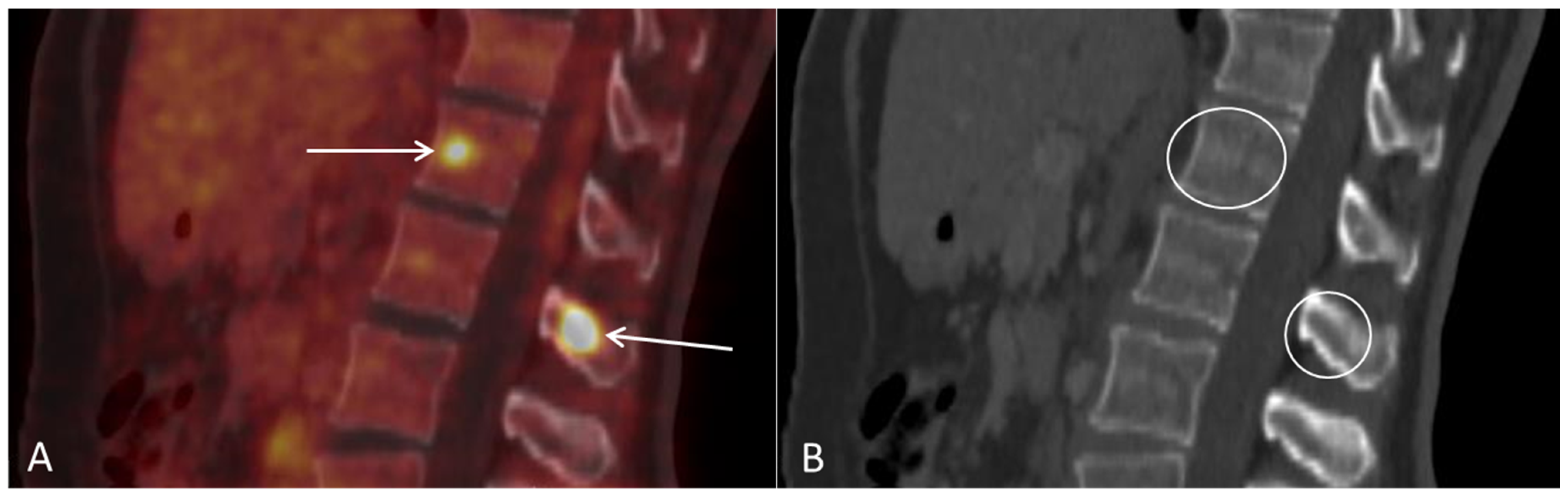 Diagnostics 12 01447 g006 550