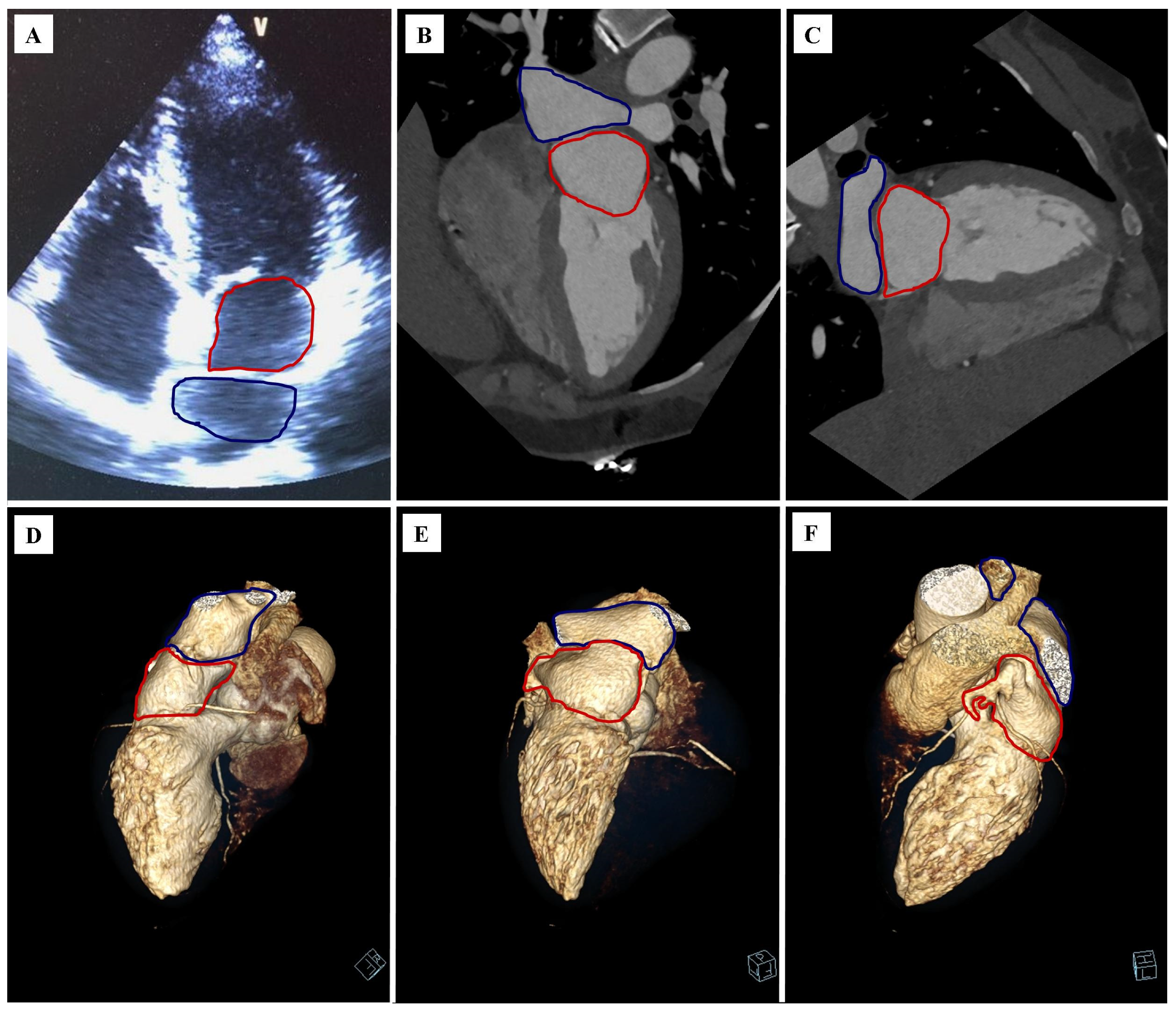Diagnostics 12 01449 g001 550