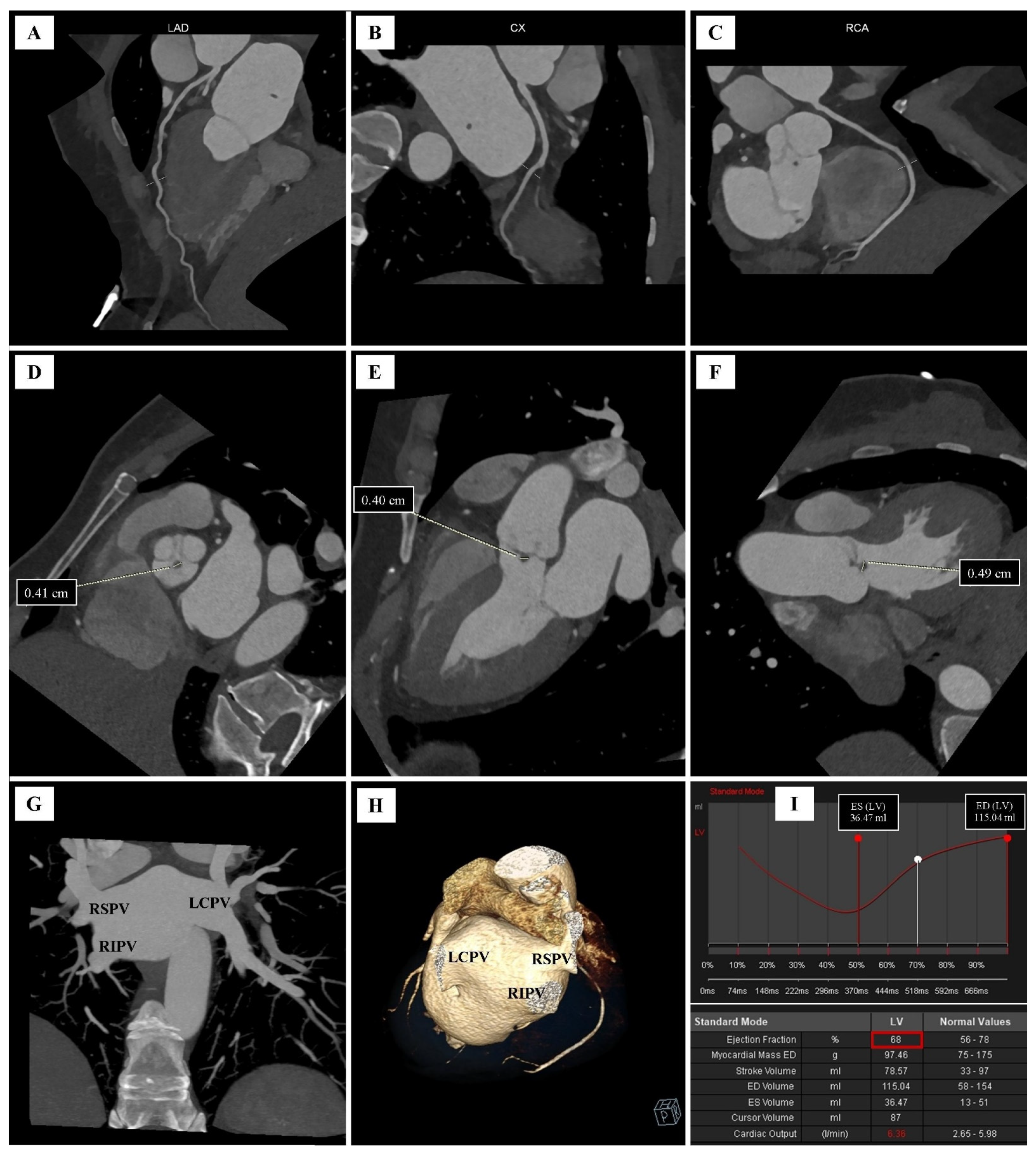 Diagnostics 12 01449 g002 550