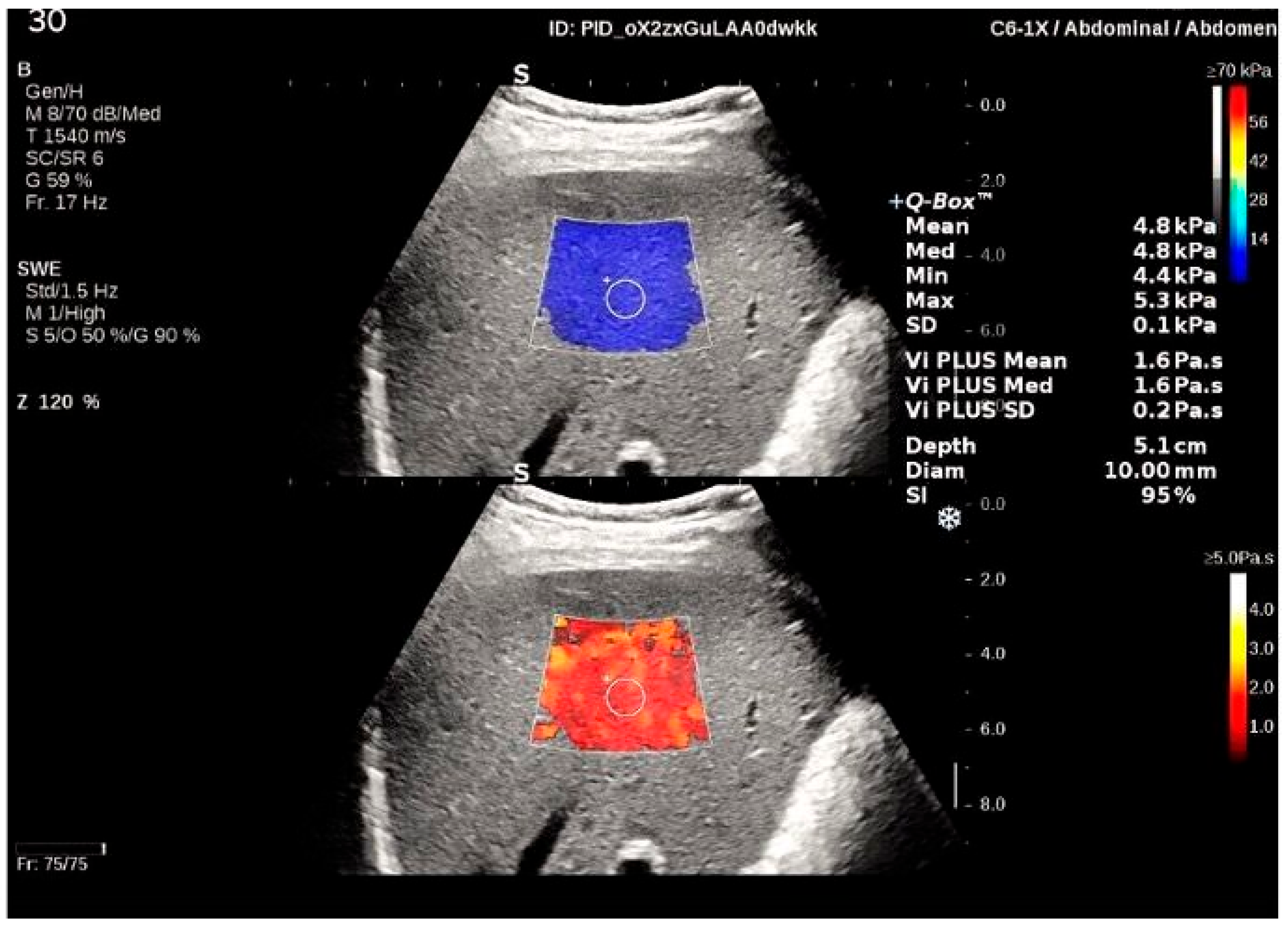 Diagnostics 12 01451 g001