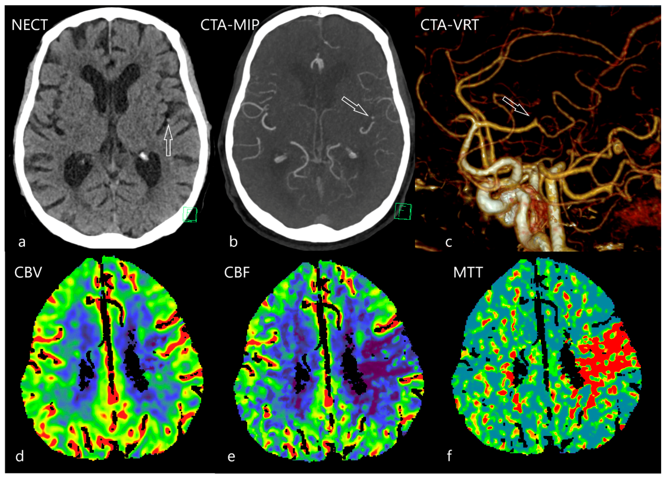 Diagnostics 12 01452 g003 Diagnostics 12 01452 g003