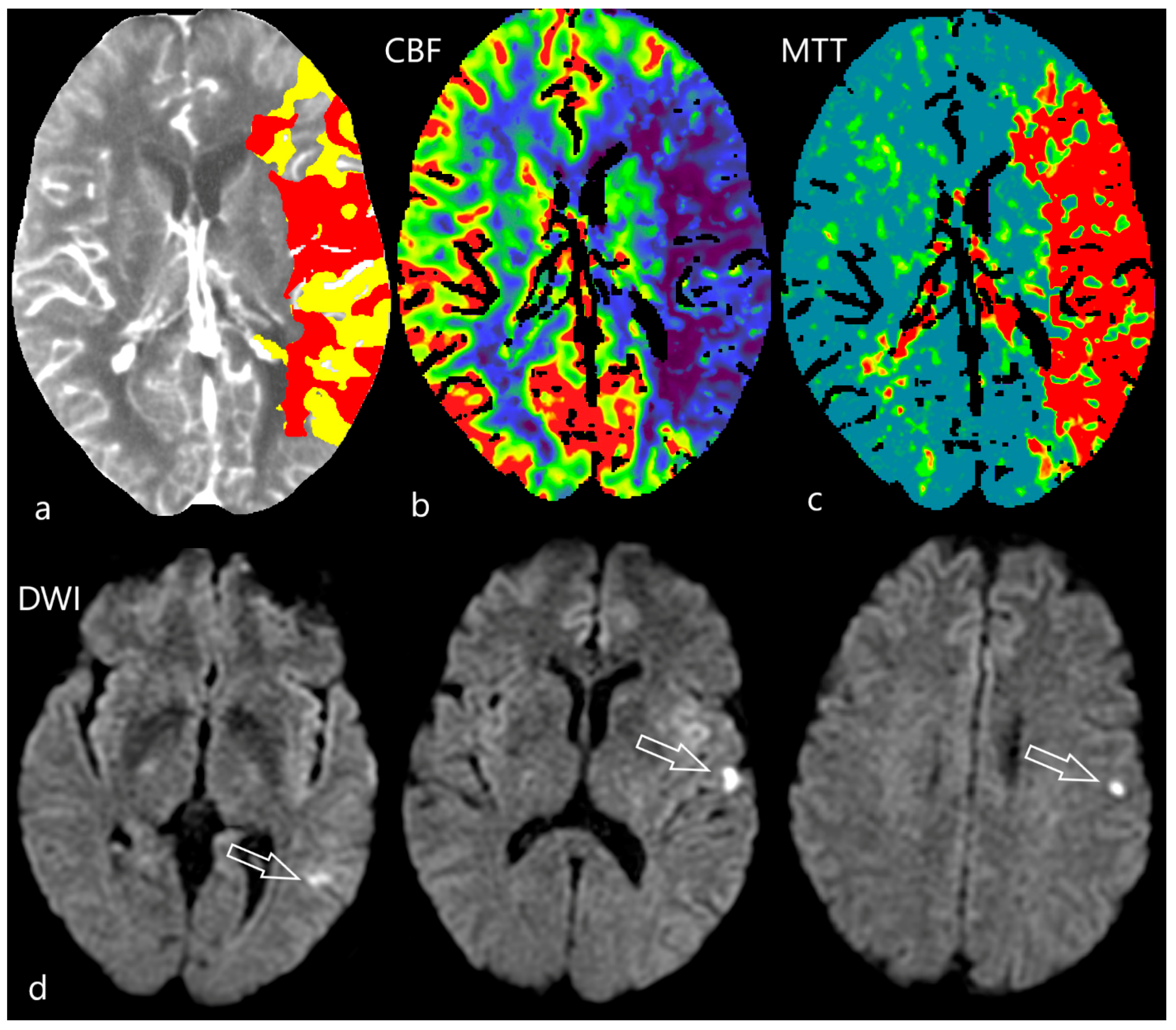 Diagnostics 12 01452 g004 Diagnostics 12 01452 g004
