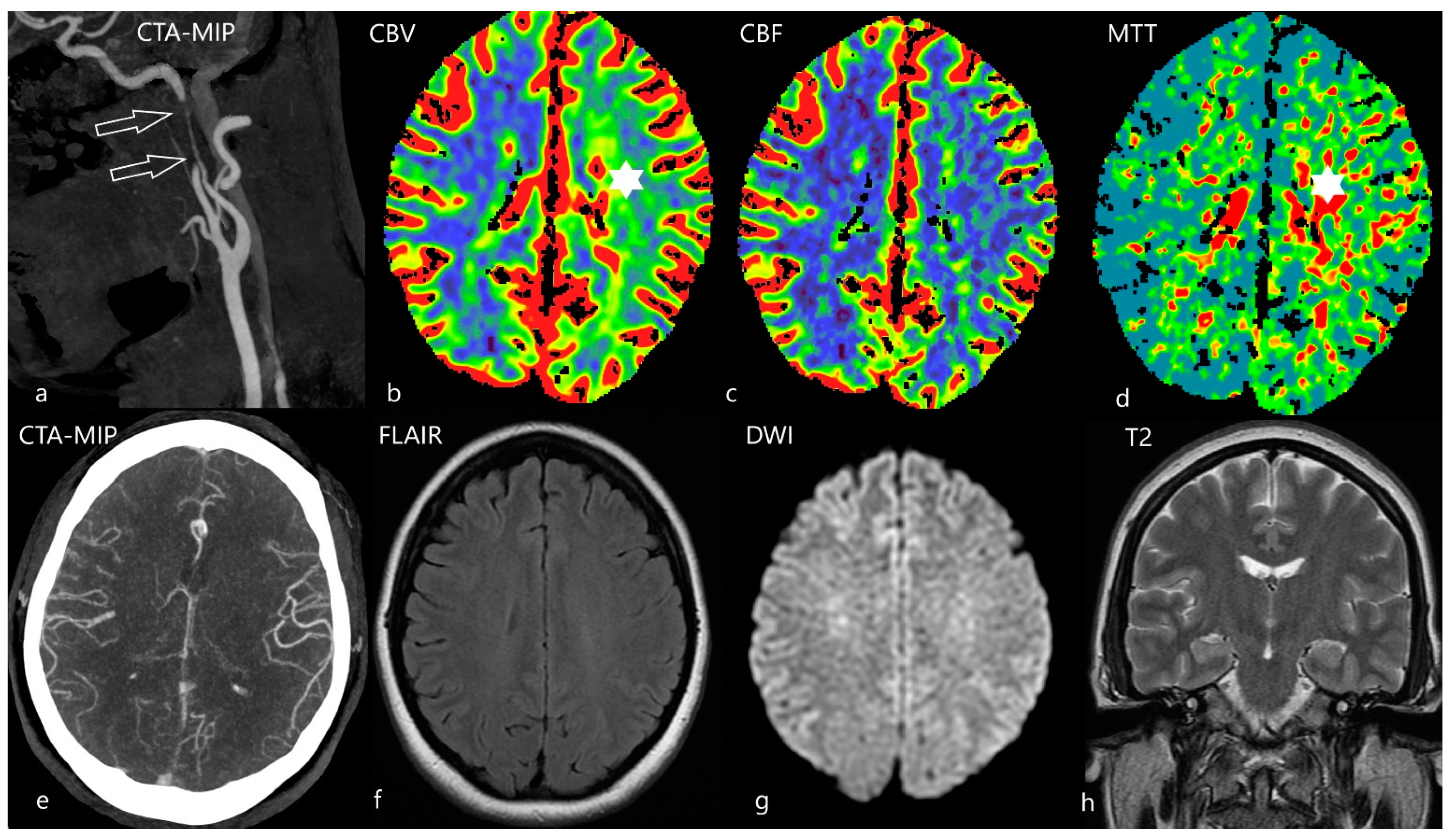 Diagnostics 12 01452 g005 Diagnostics 12 01452 g005