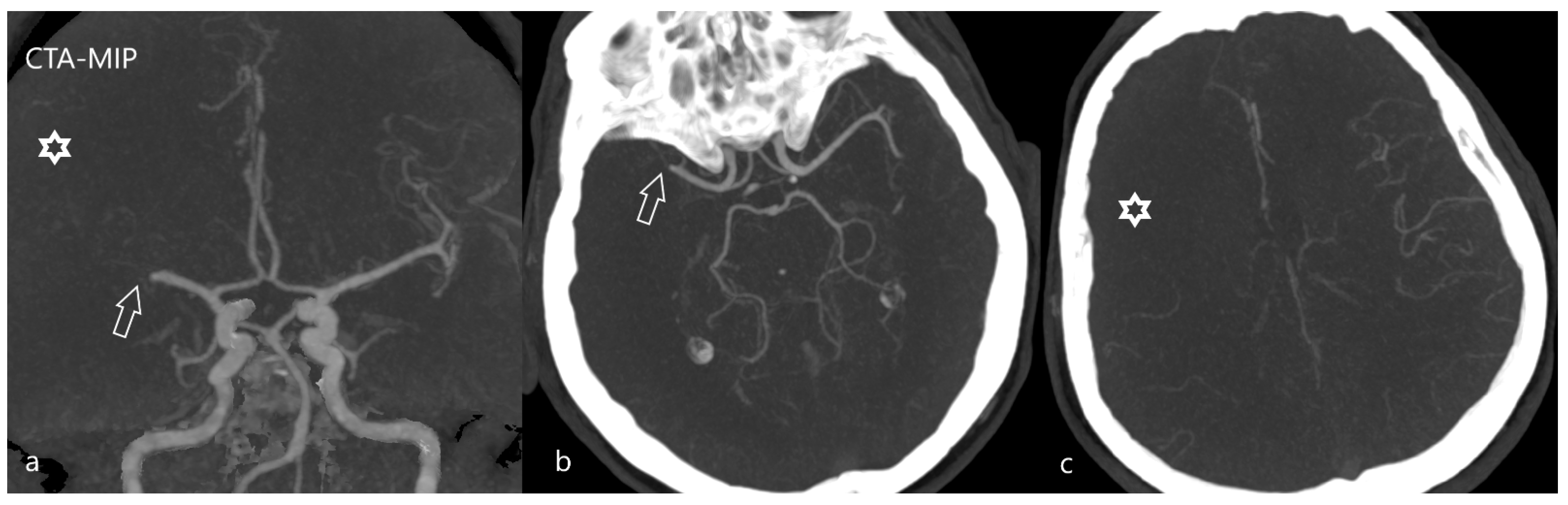 Diagnostics 12 01452 g006 Diagnostics 12 01452 g006