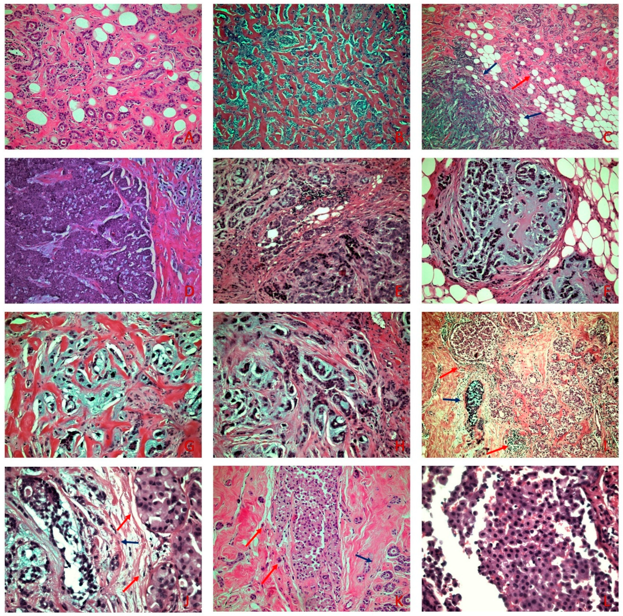癌の病理組織アトラスATLAS OF CANCER HISTOPATHOLOGY 癌の病理組織アトラスATLAS OF CANCER HISTOPATHOLOGY