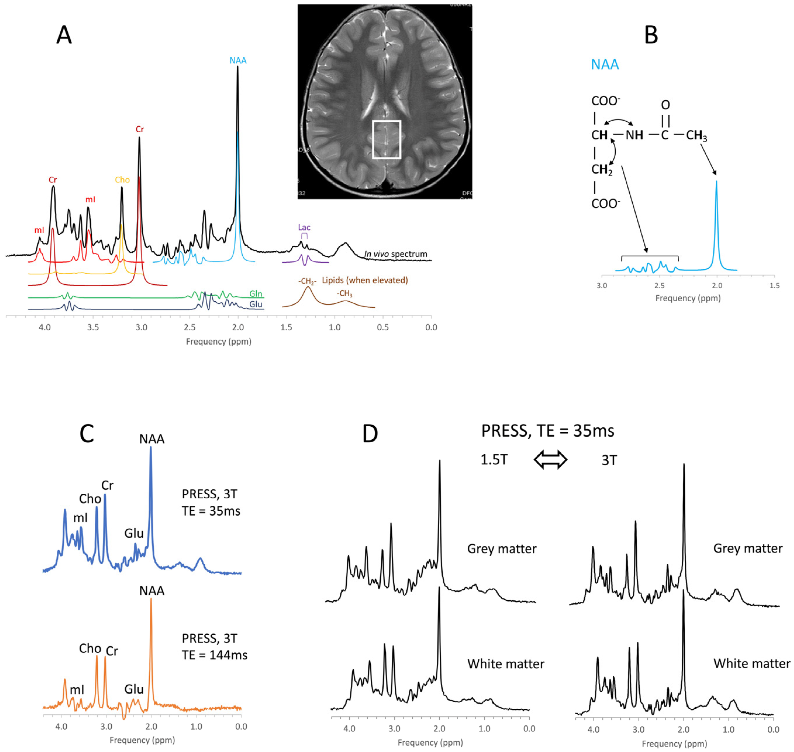 Diagnostics Free FullText Proton MR Spectroscopy of Pediatric