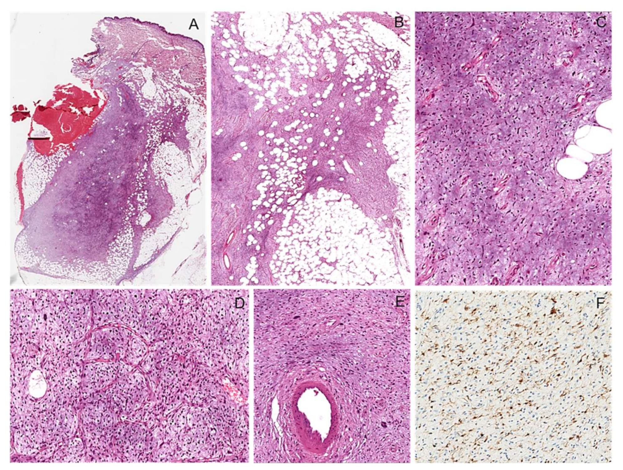 Diagnostics 12 01463 g005 550