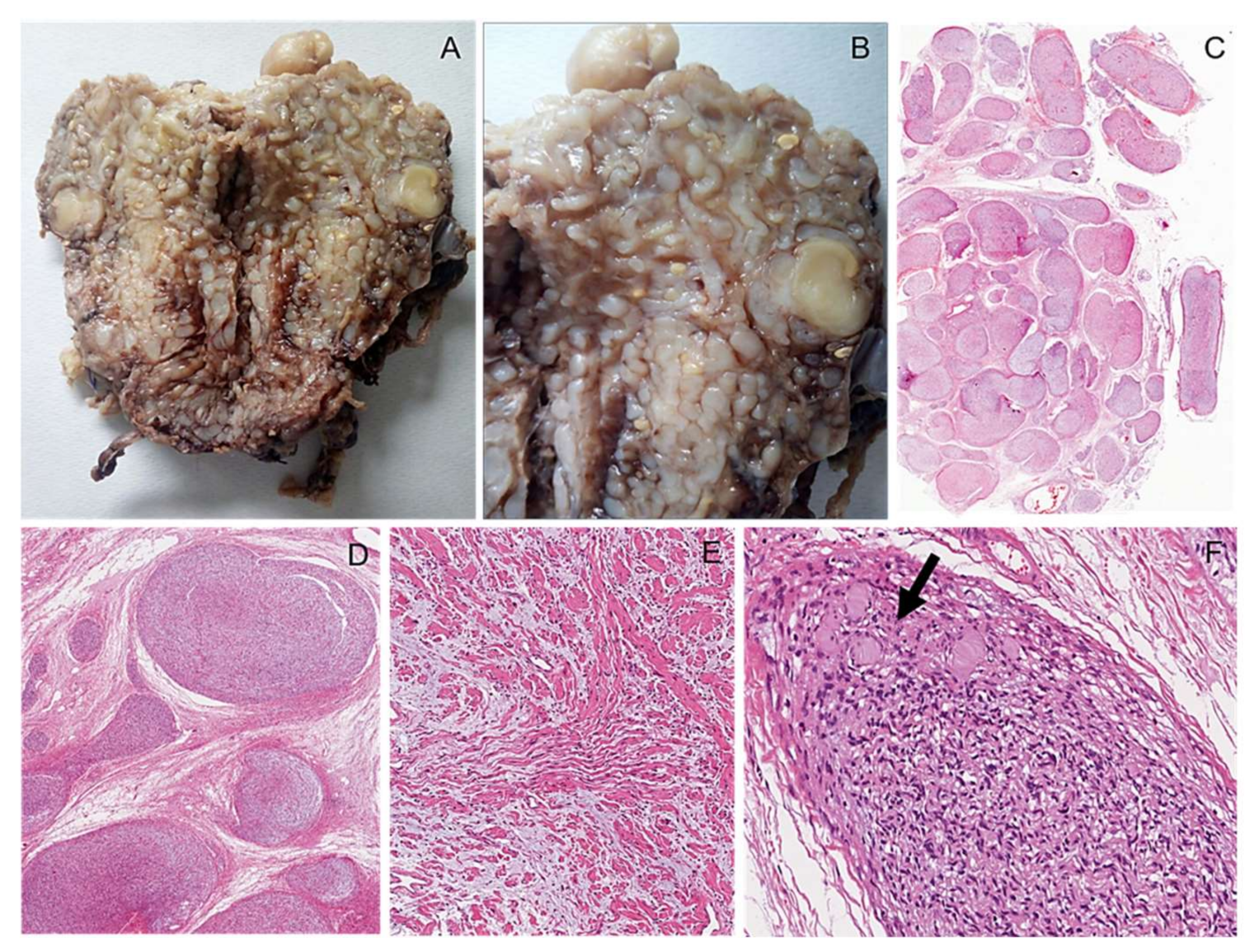 Diagnostics 12 01463 g006 550