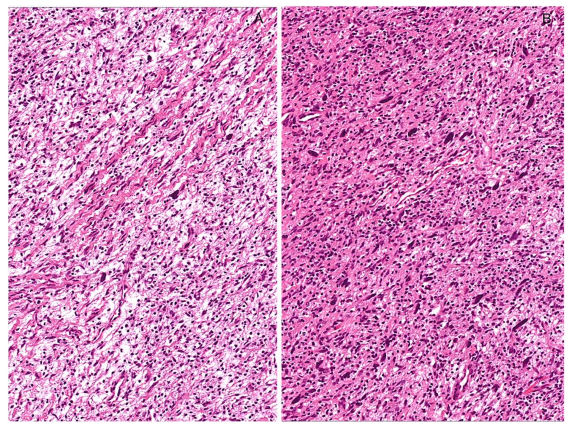 Diagnostics 12 01463 g007 550