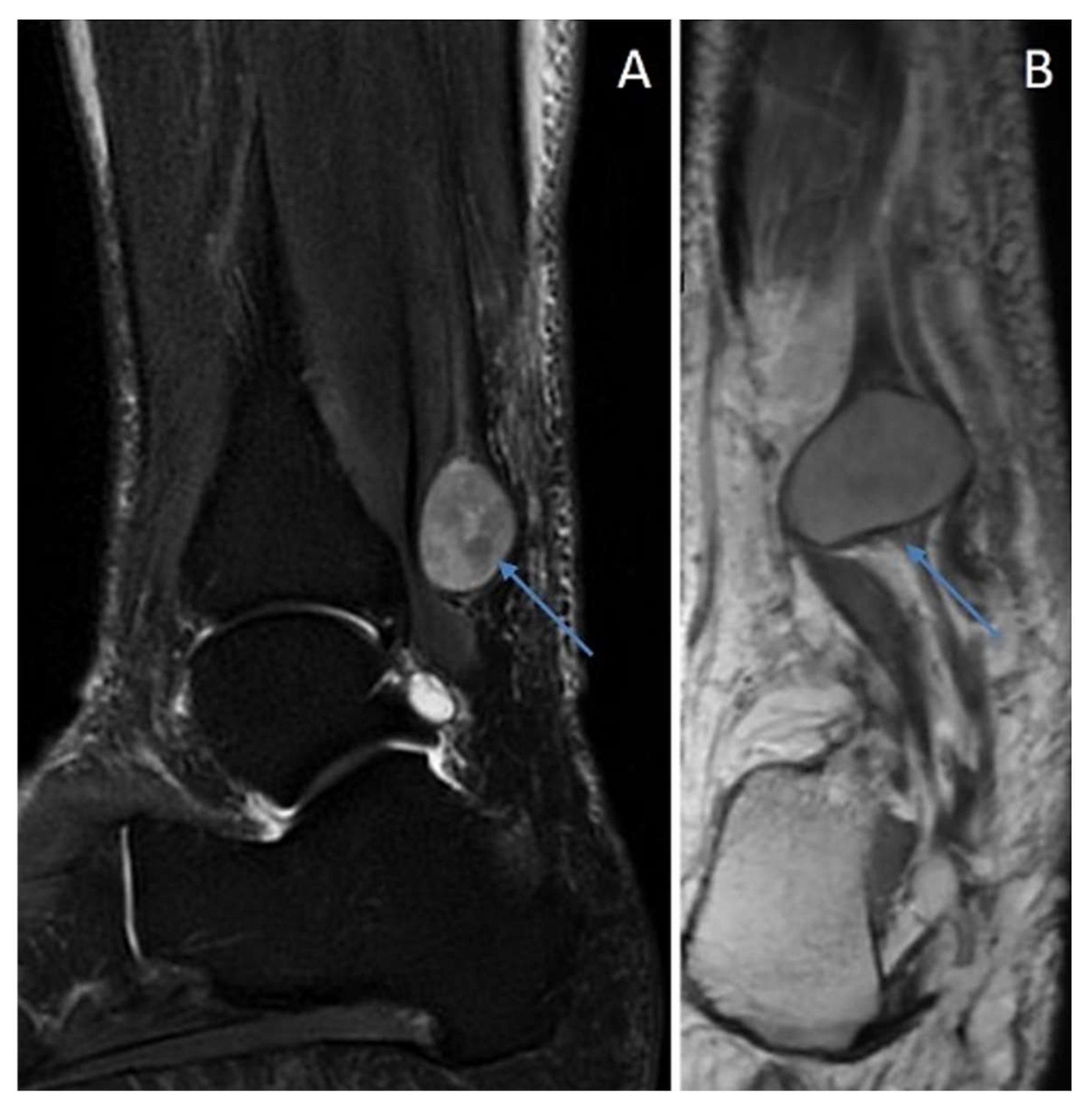Diagnostics 12 01463 g010 550