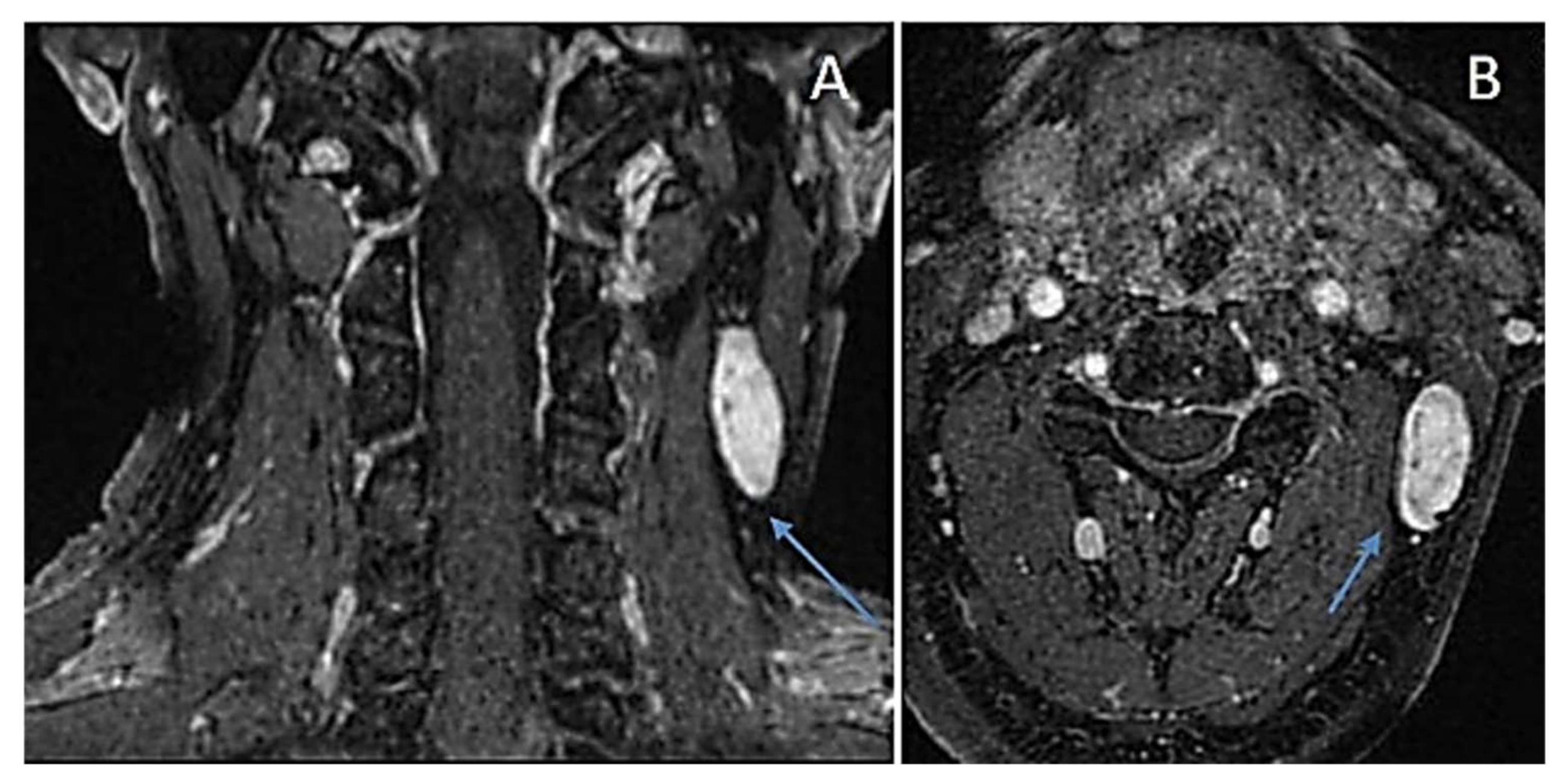 Diagnostics 12 01463 g011 550
