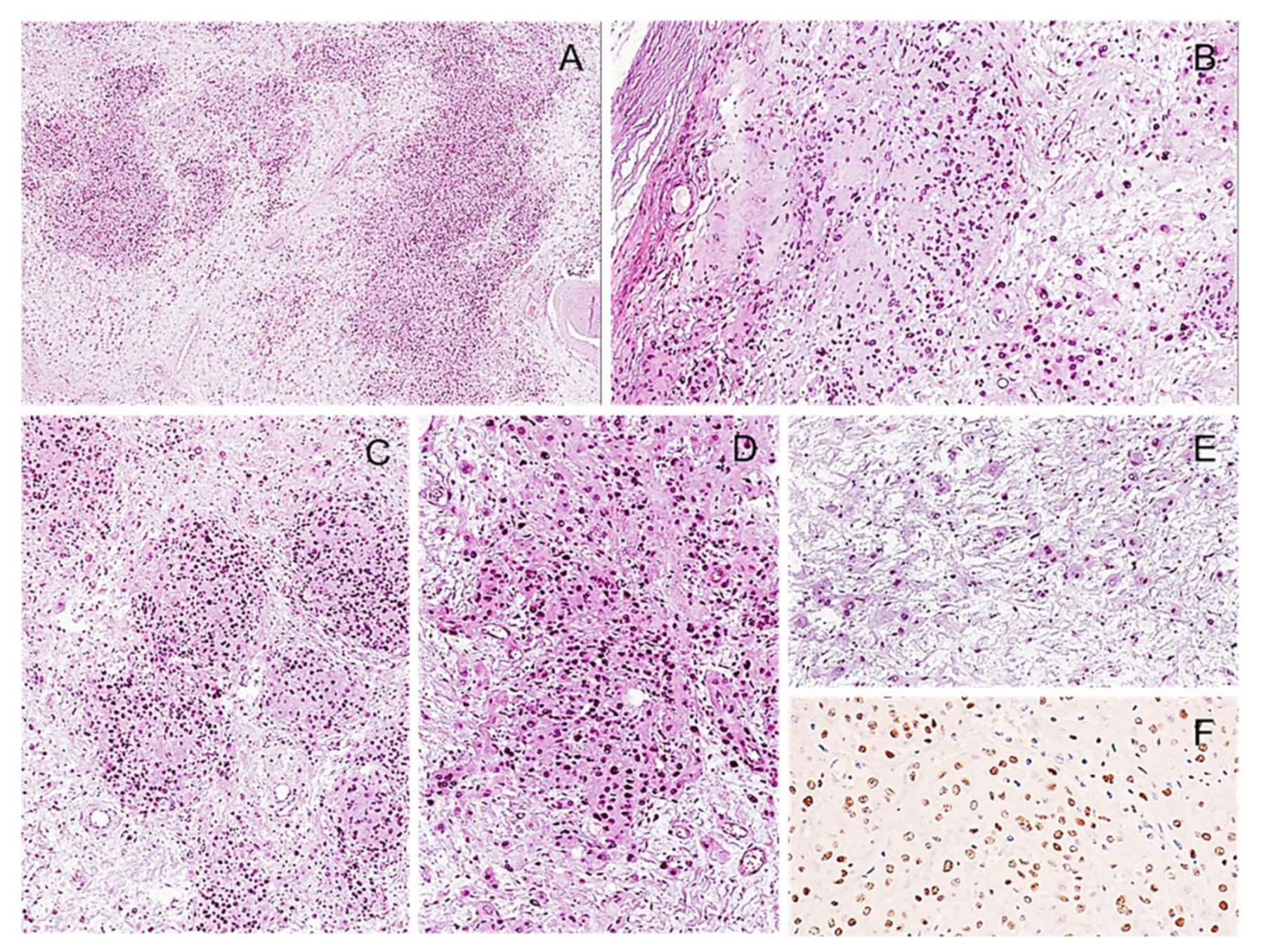 Diagnostics 12 01463 g017 550