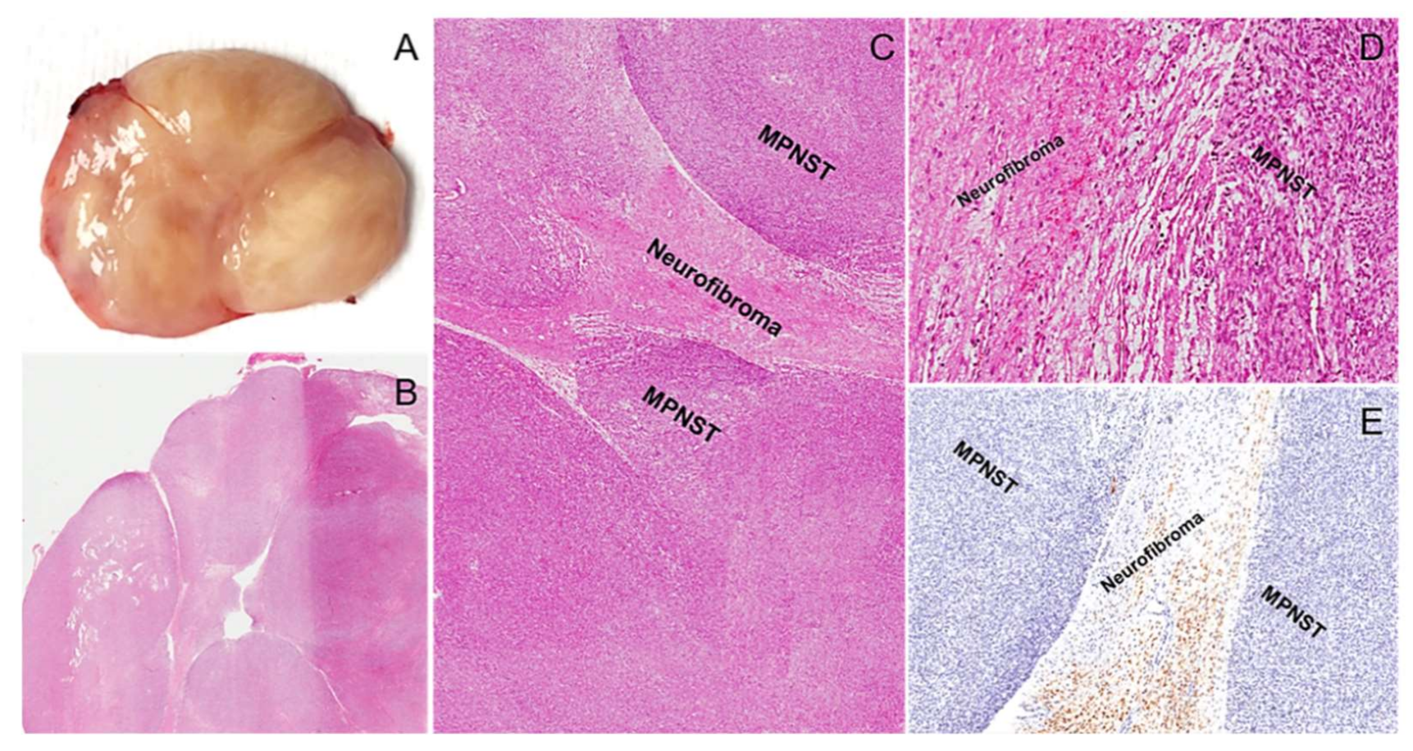 Diagnostics 12 01463 g021 550