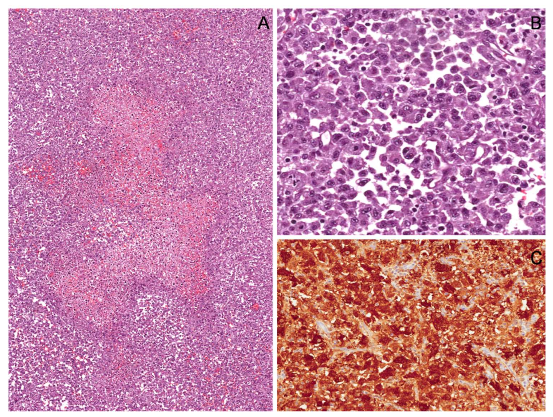 Diagnostics 12 01463 g024 550
