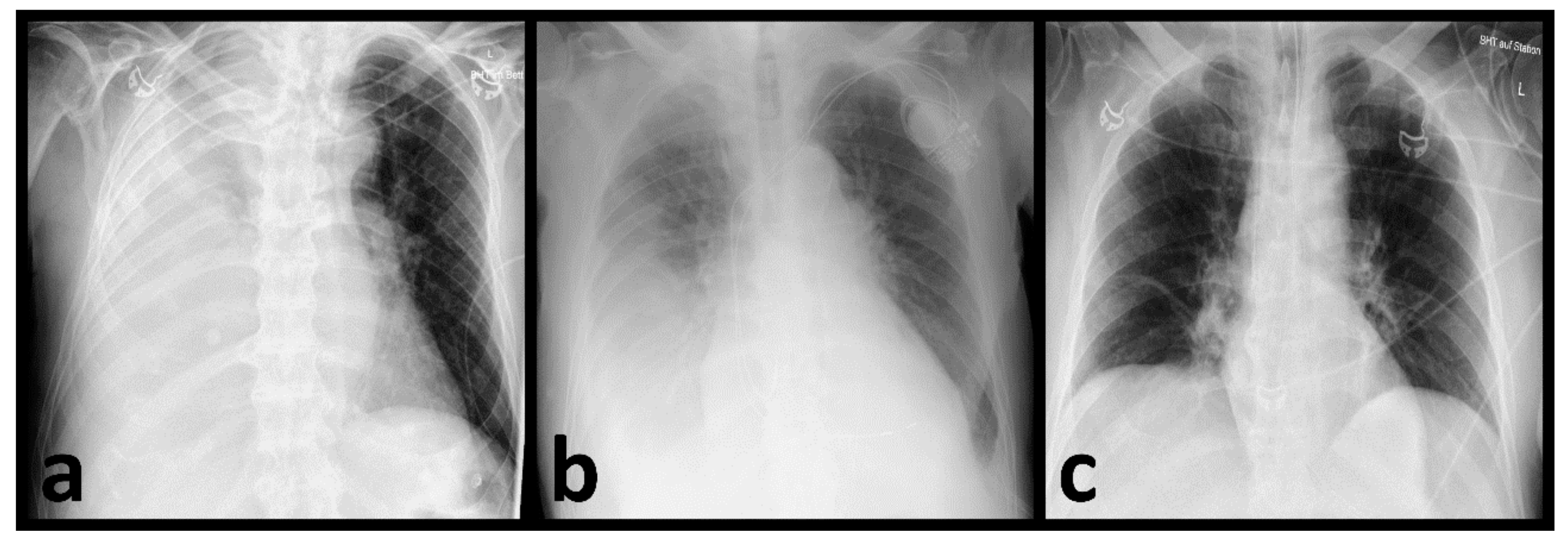 Diagnostics 12 01465 g005