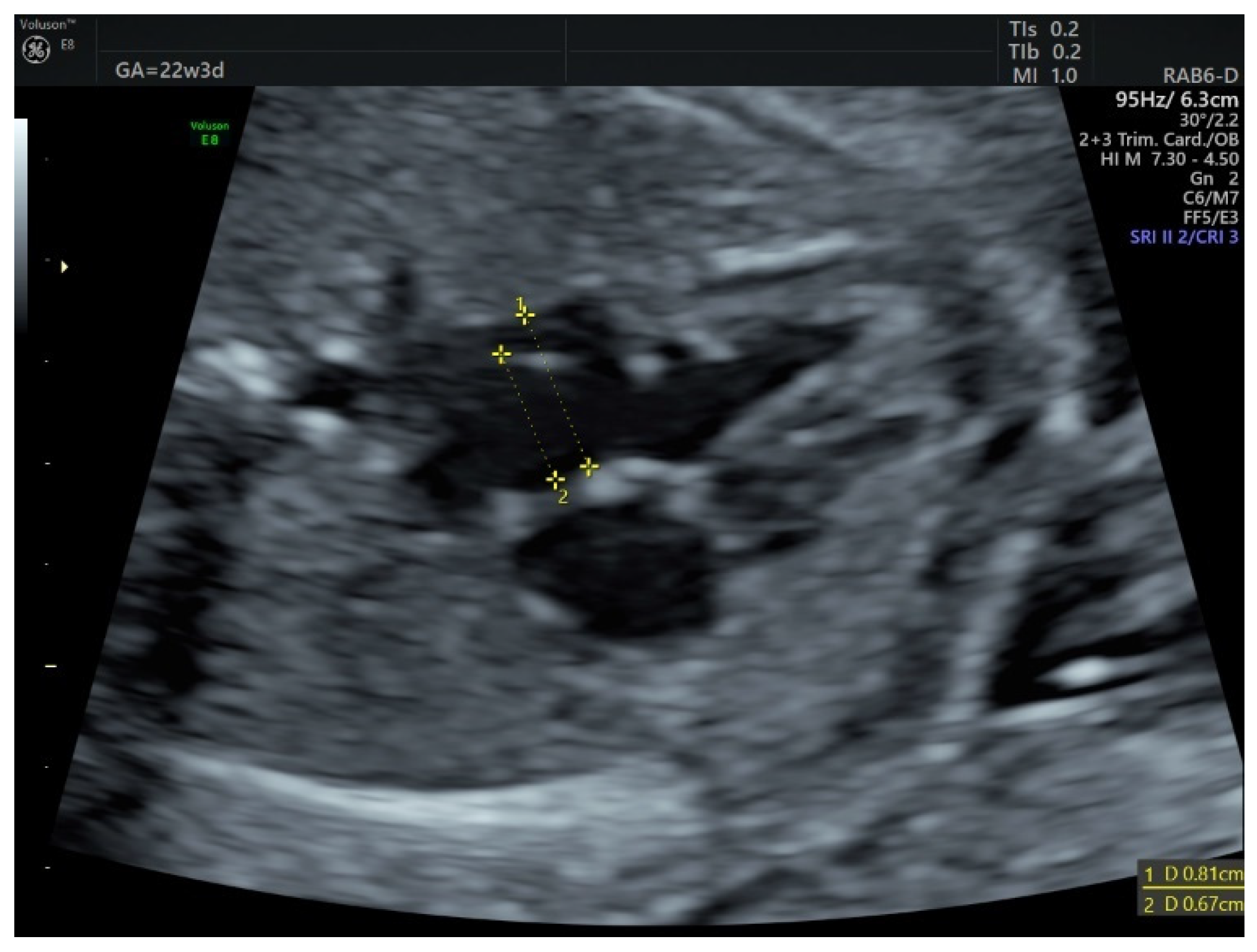 Diagnostics 12 01469 g001