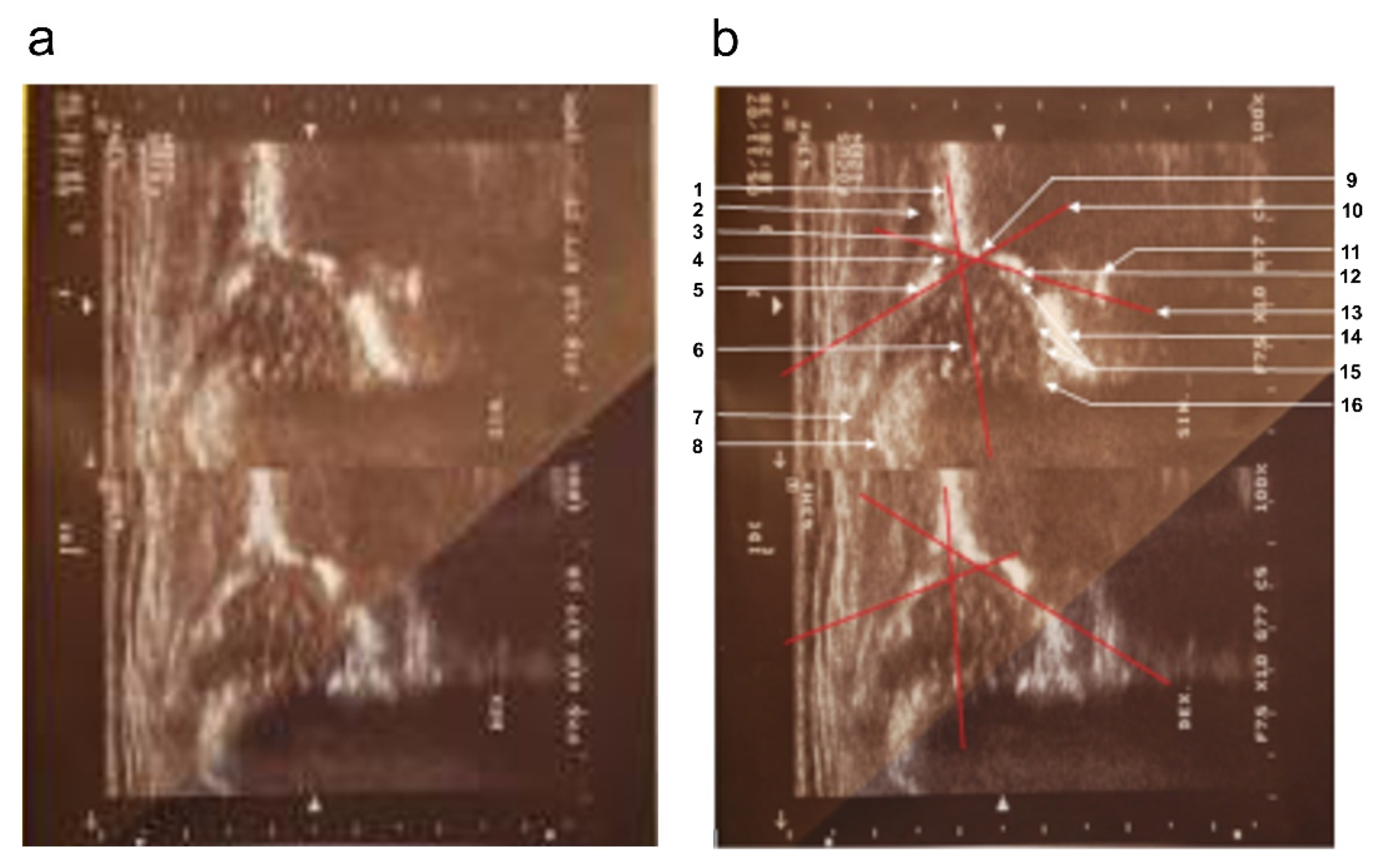 Diagnostics 12 01472 g001 550