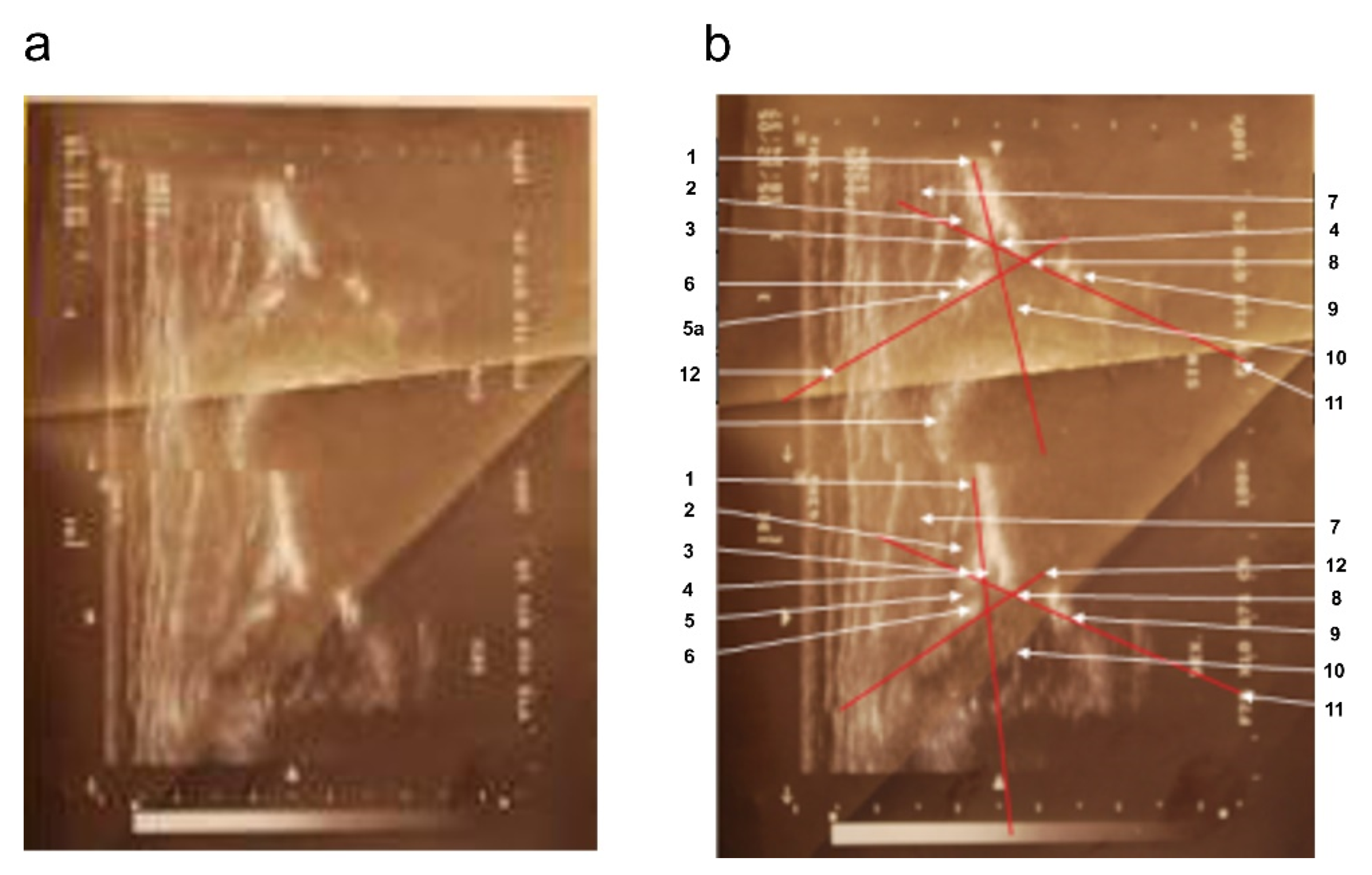 Diagnostics 12 01472 g002 550