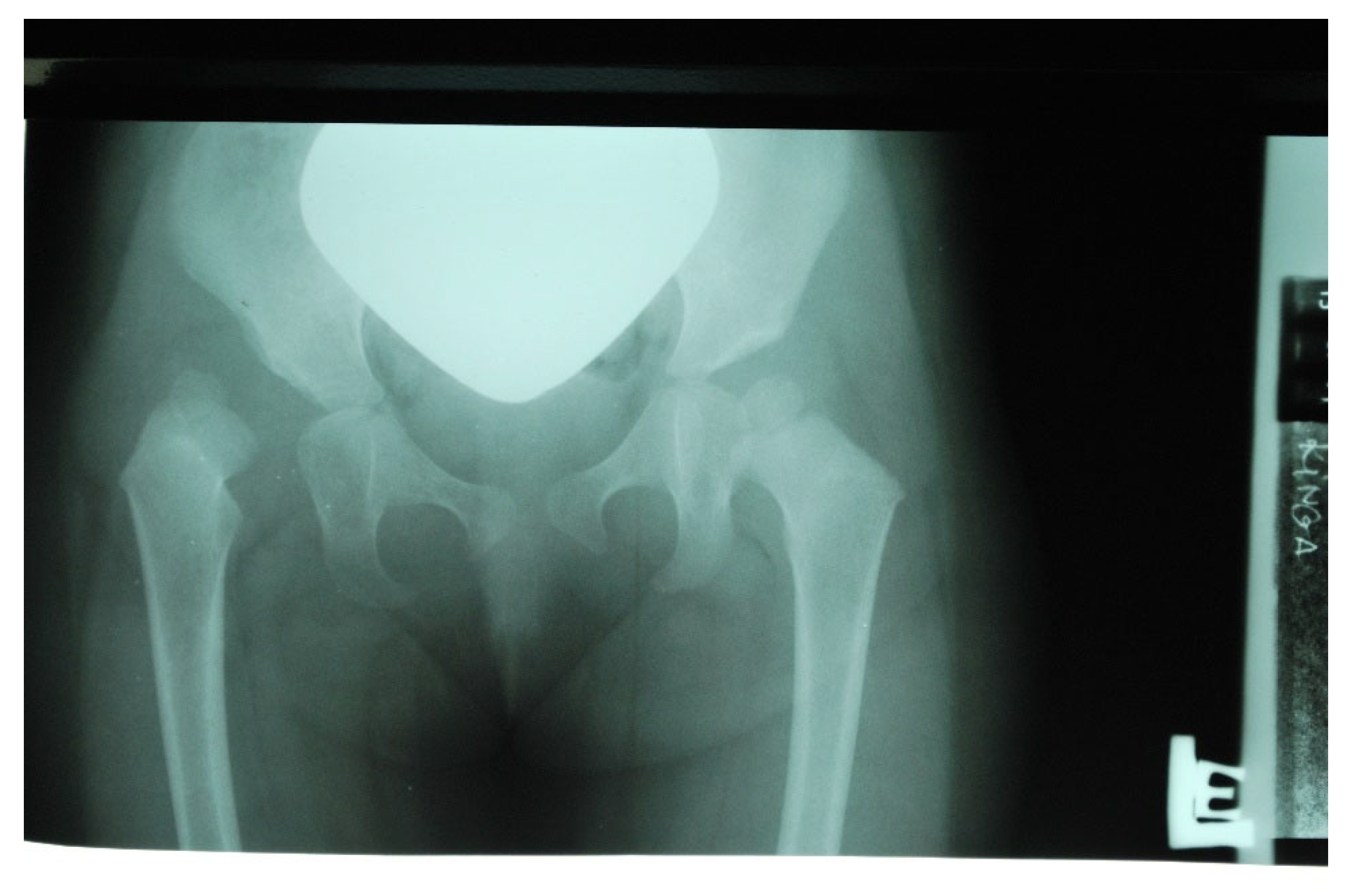 Diagnostics 12 01472 g003 550