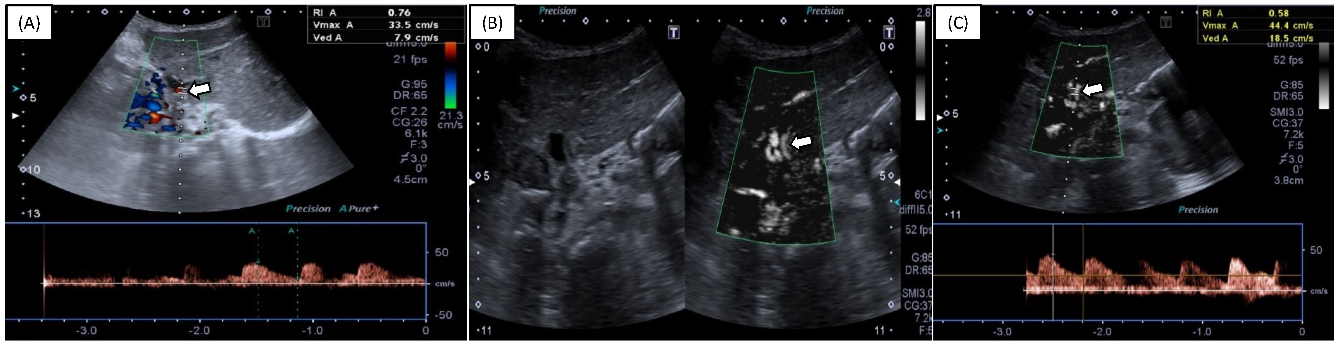 Diagnostics 12 01476 g003