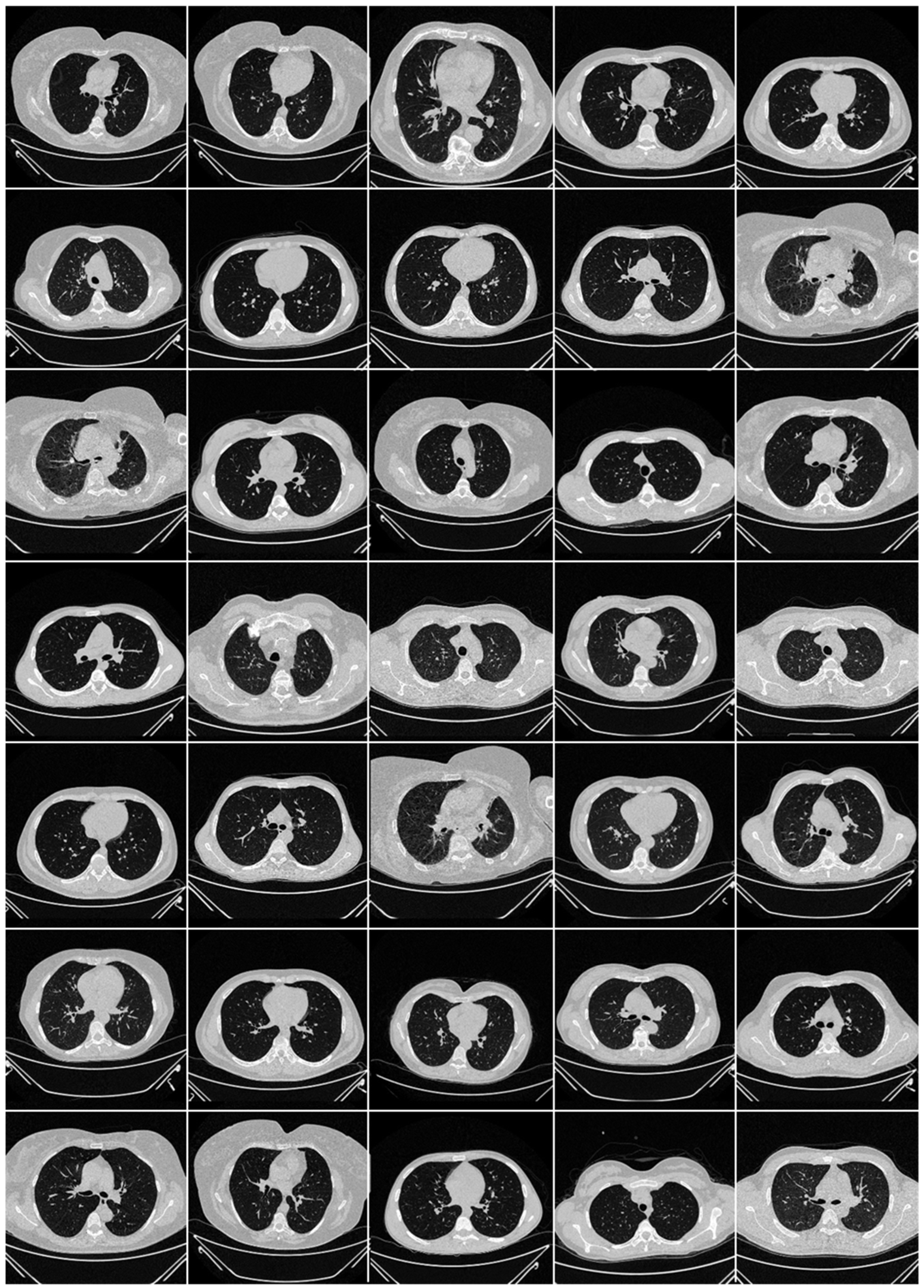 Diagnostics 12 01482 g003 550