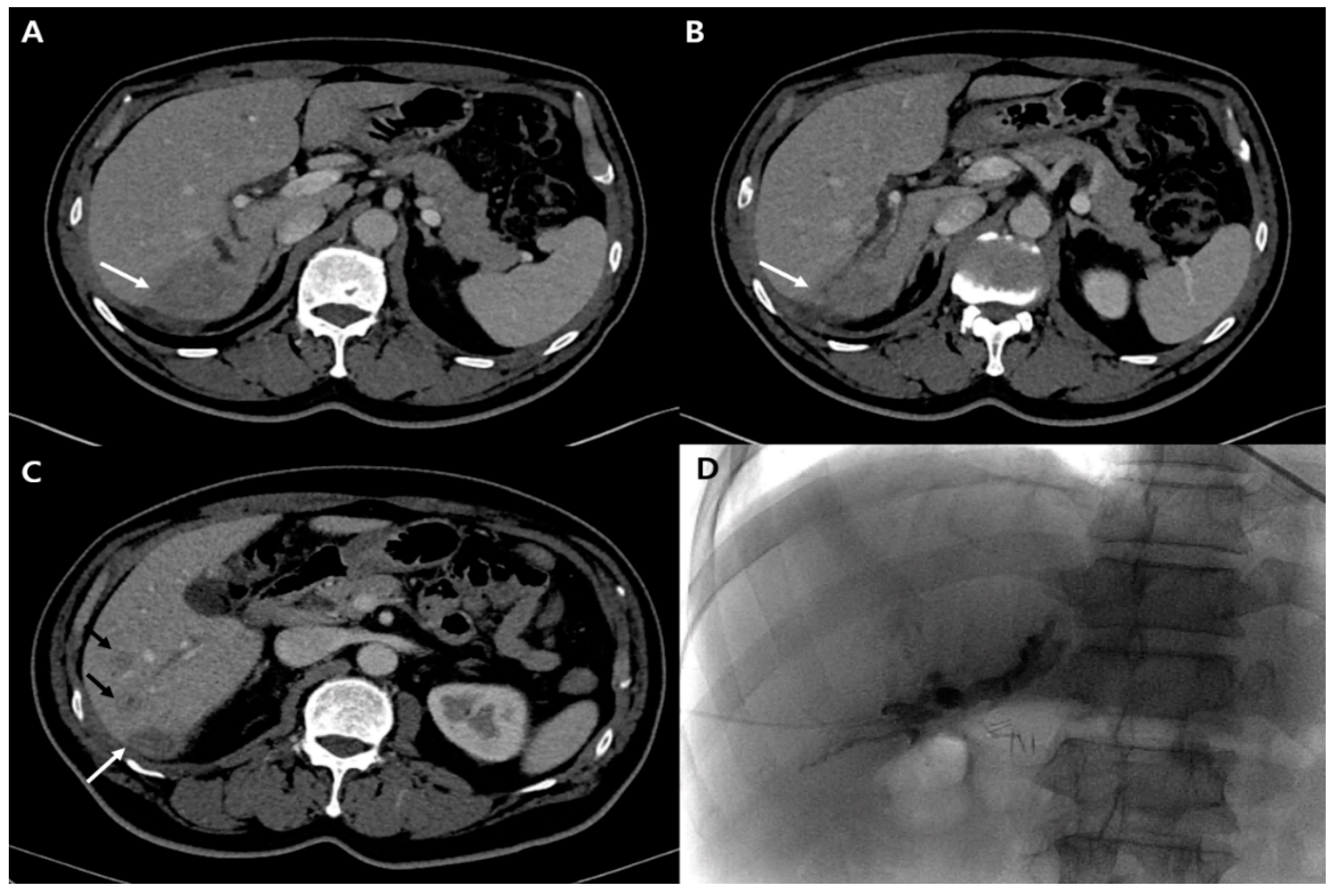 Diagnostics 12 01497 g003 550