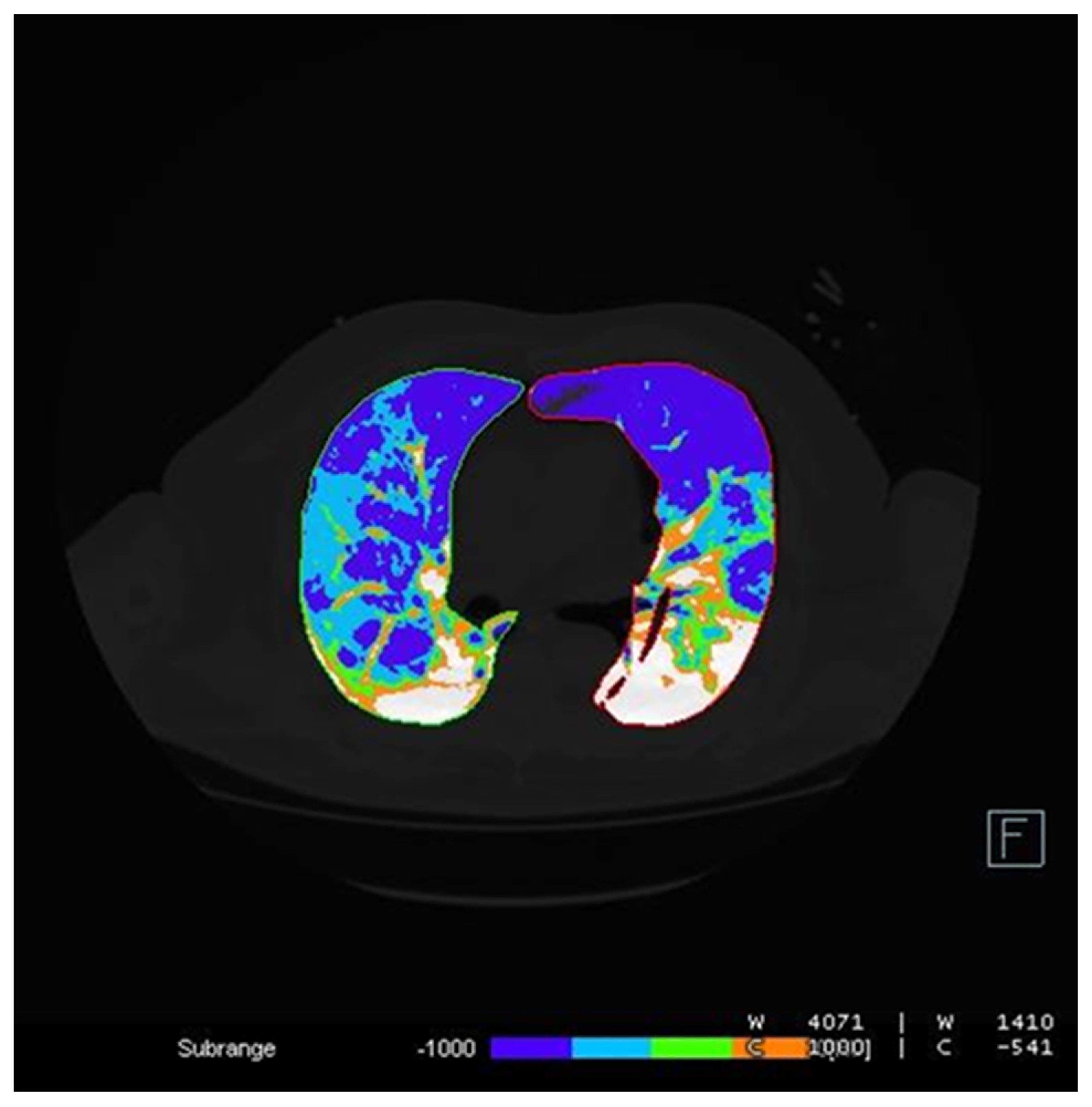 Diagnostics 12 01501 g008 550