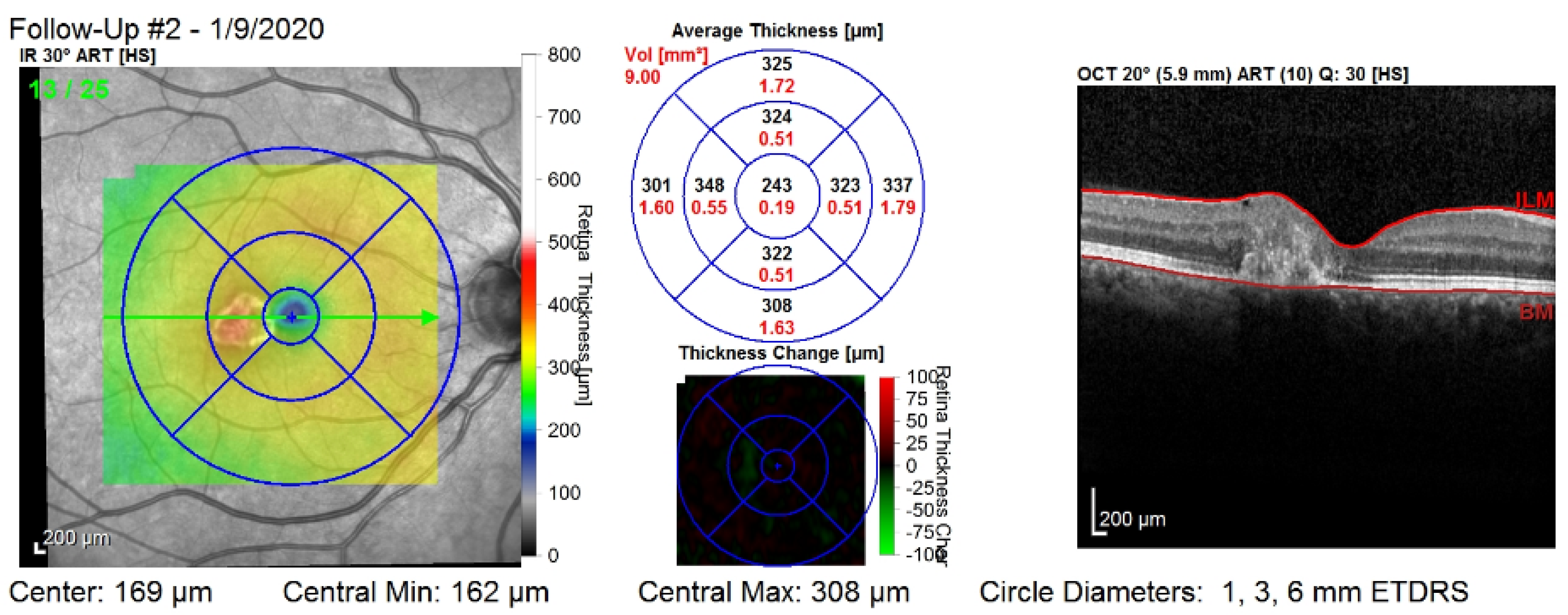 Diagnostics 12 01504 g001 550