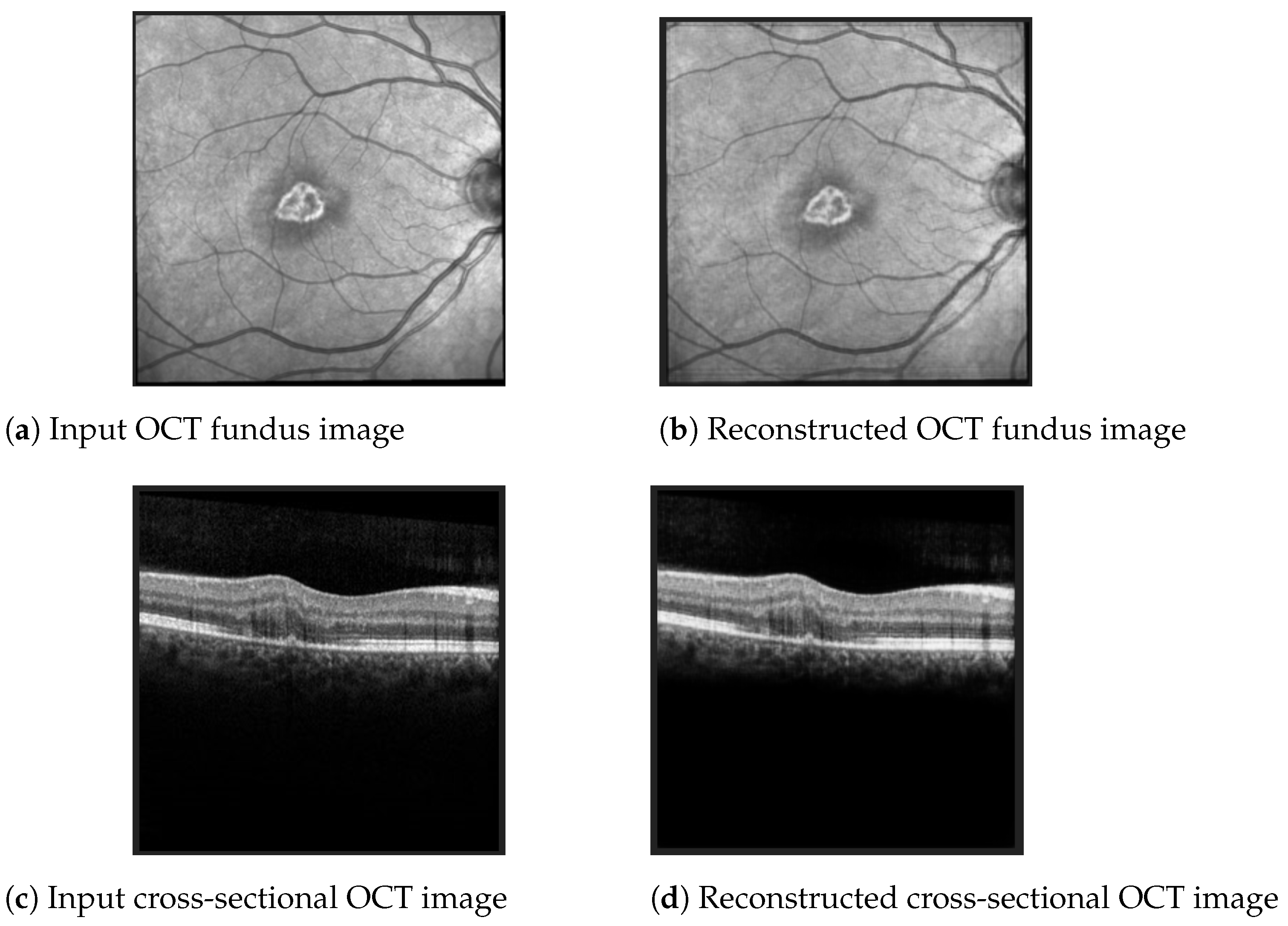 Diagnostics 12 01504 g008 550