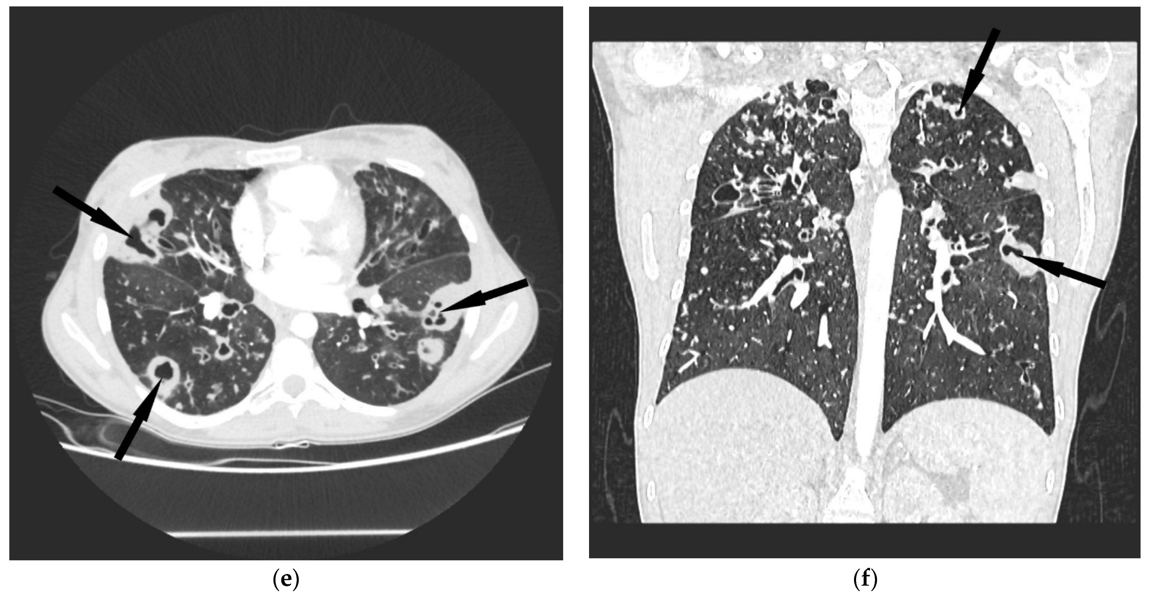 Diagnostics 12 01514 g001b