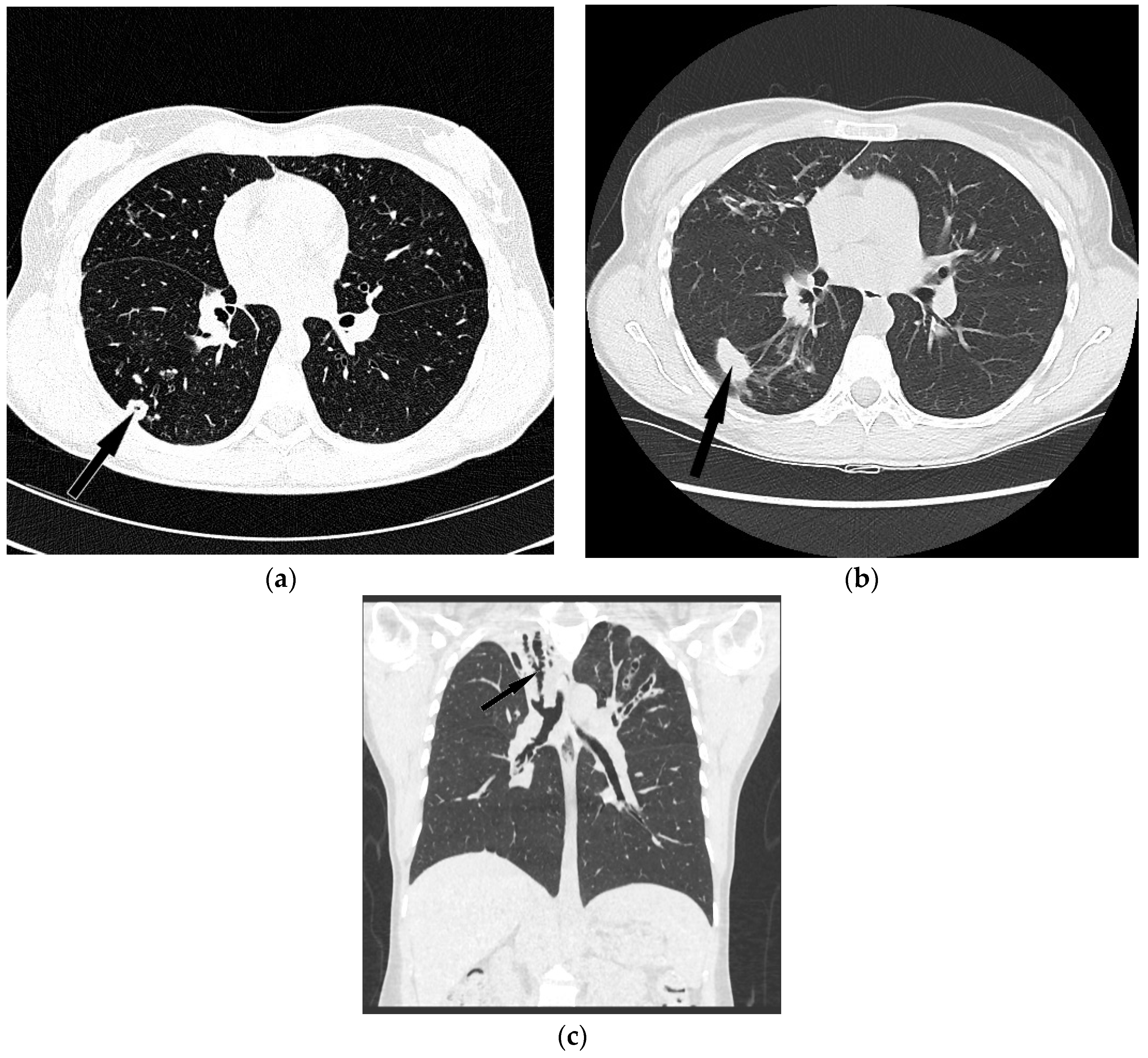 Diagnostics 12 01514 g002