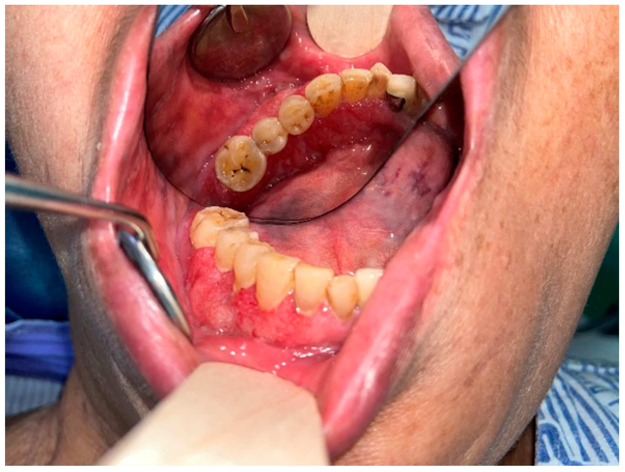 Diagnostics 12 01518 g001