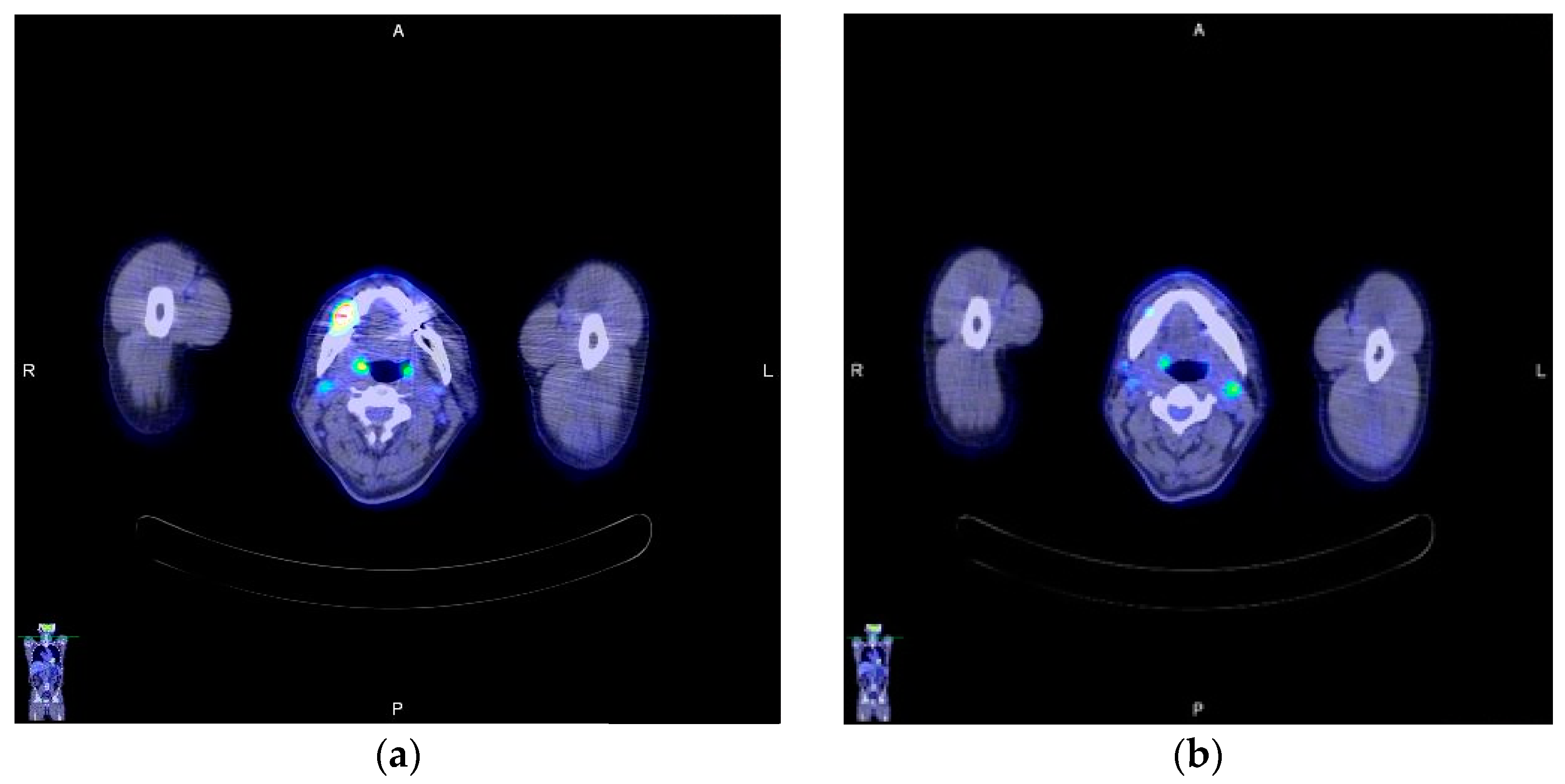 Diagnostics 12 01518 g004