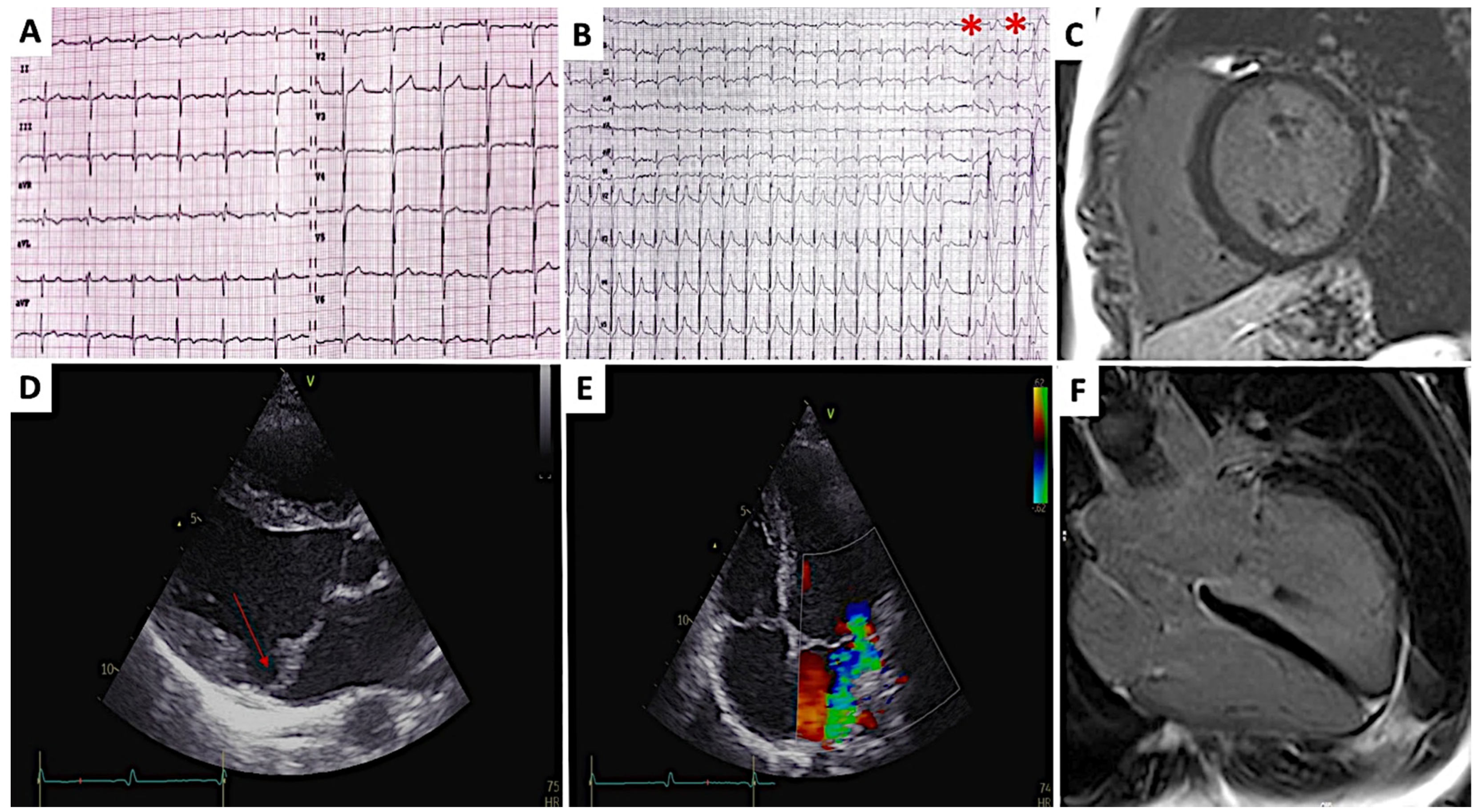 Diagnostics 12 01519 g001 550