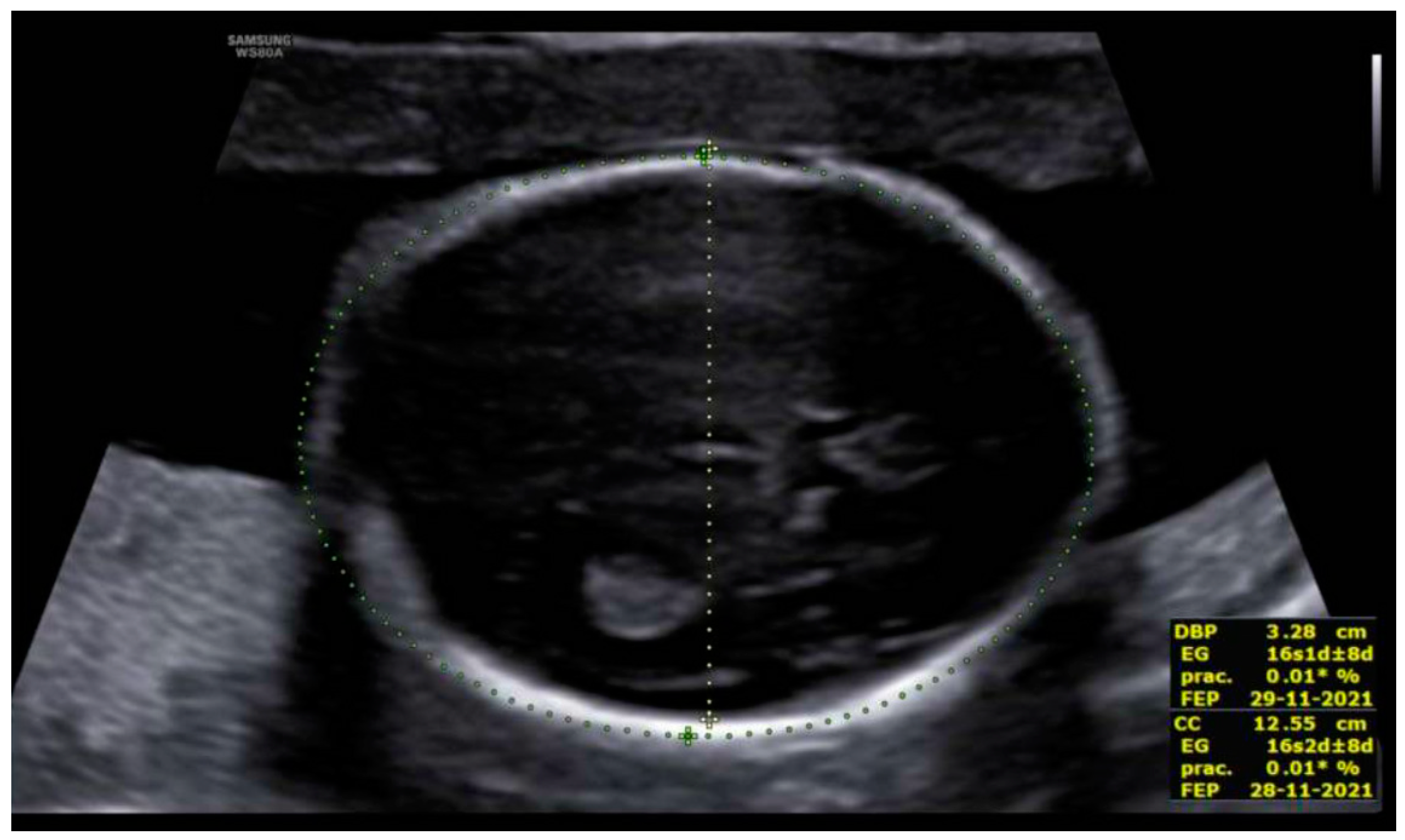 Diagnostics 12 01535 g002