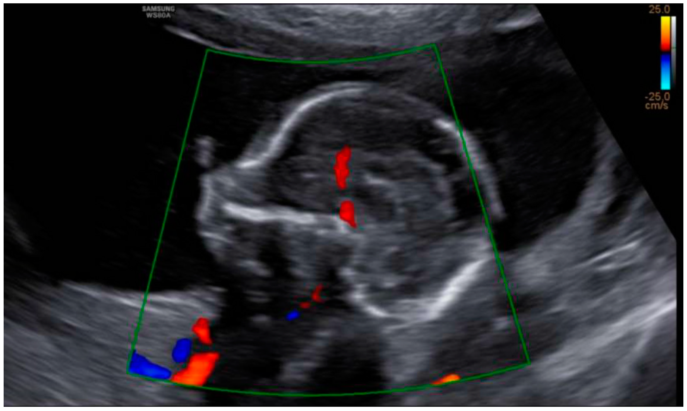 Diagnostics 12 01535 g003