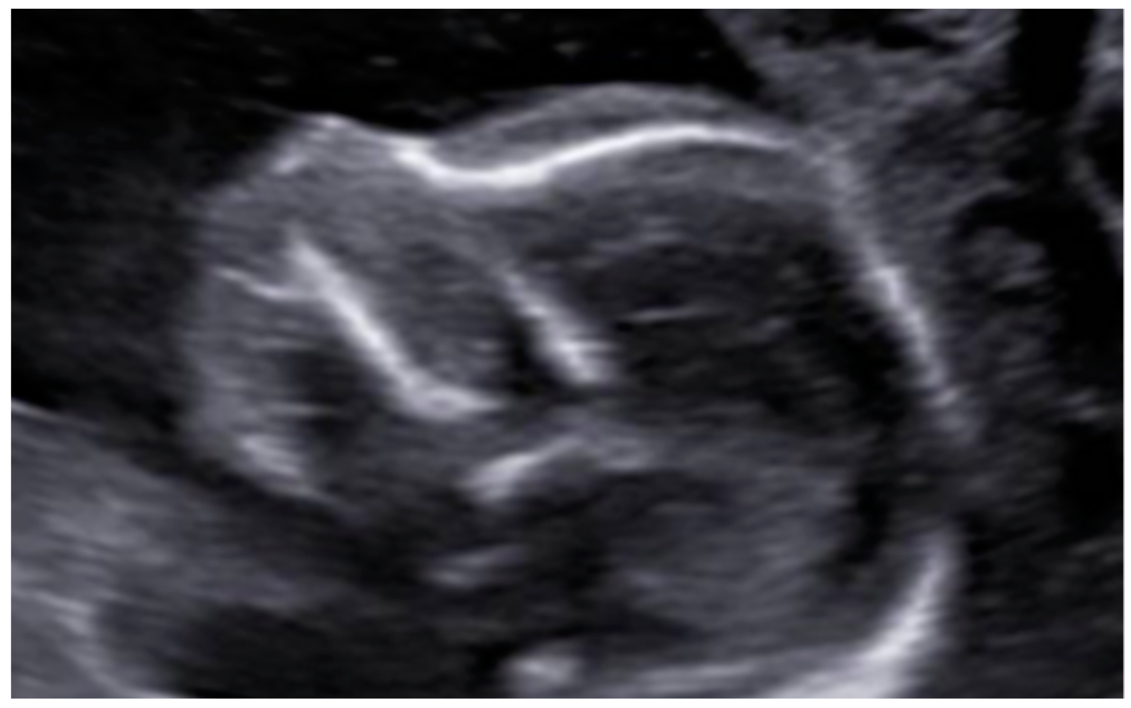 Diagnostics 12 01535 g005