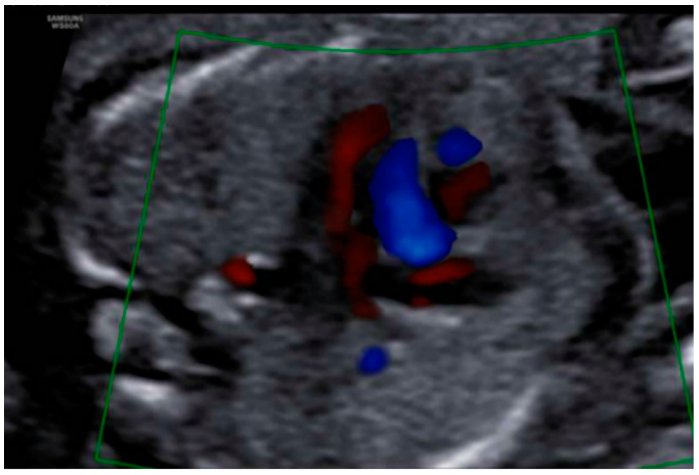 Diagnostics 12 01535 g008