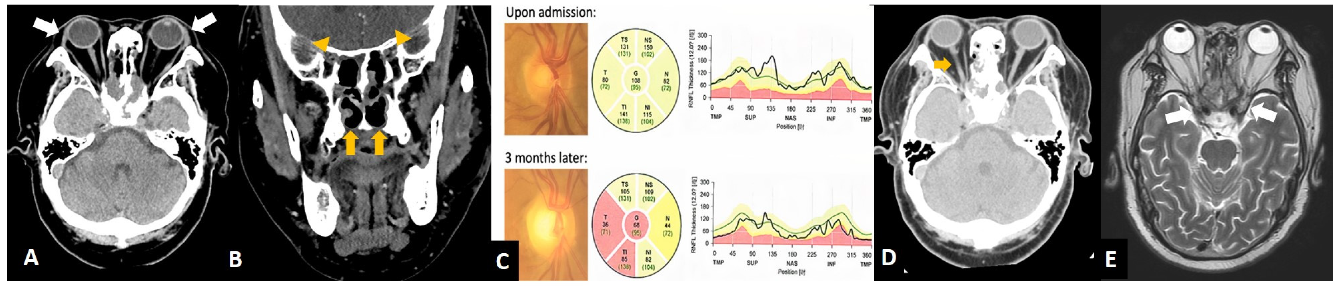 Diagnostics 12 01540 g003 Diagnostics 12 01540 g003