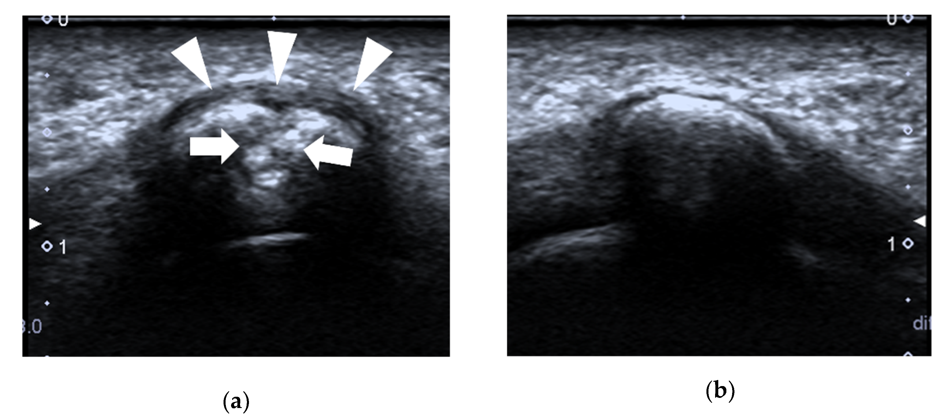 Diagnostics 12 01541 g011a