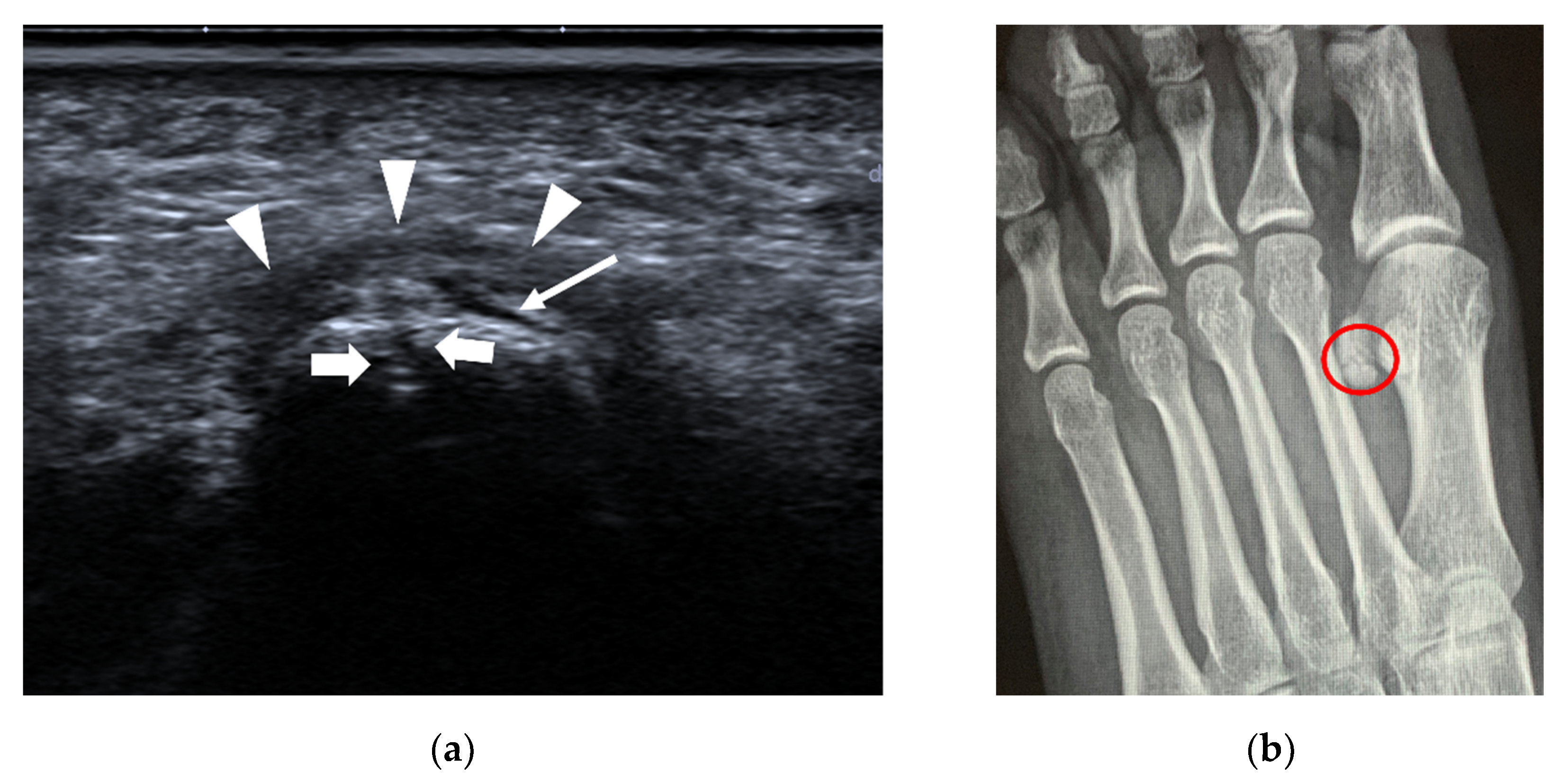 Diagnostics 12 01541 g012