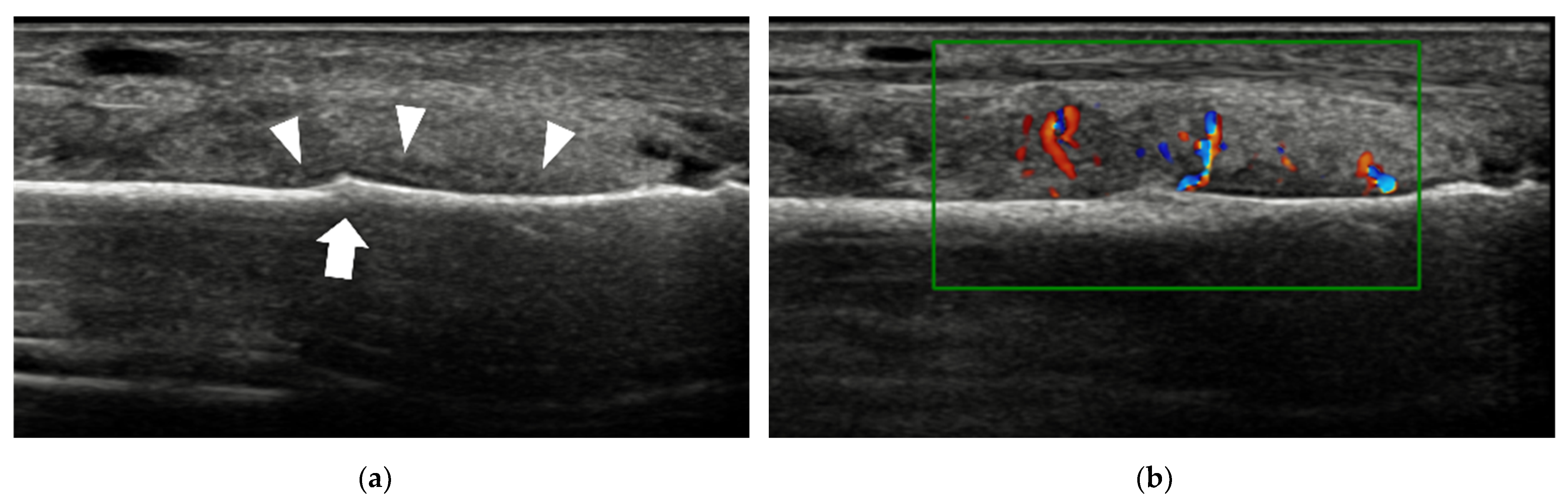 Diagnostics 12 01541 g013