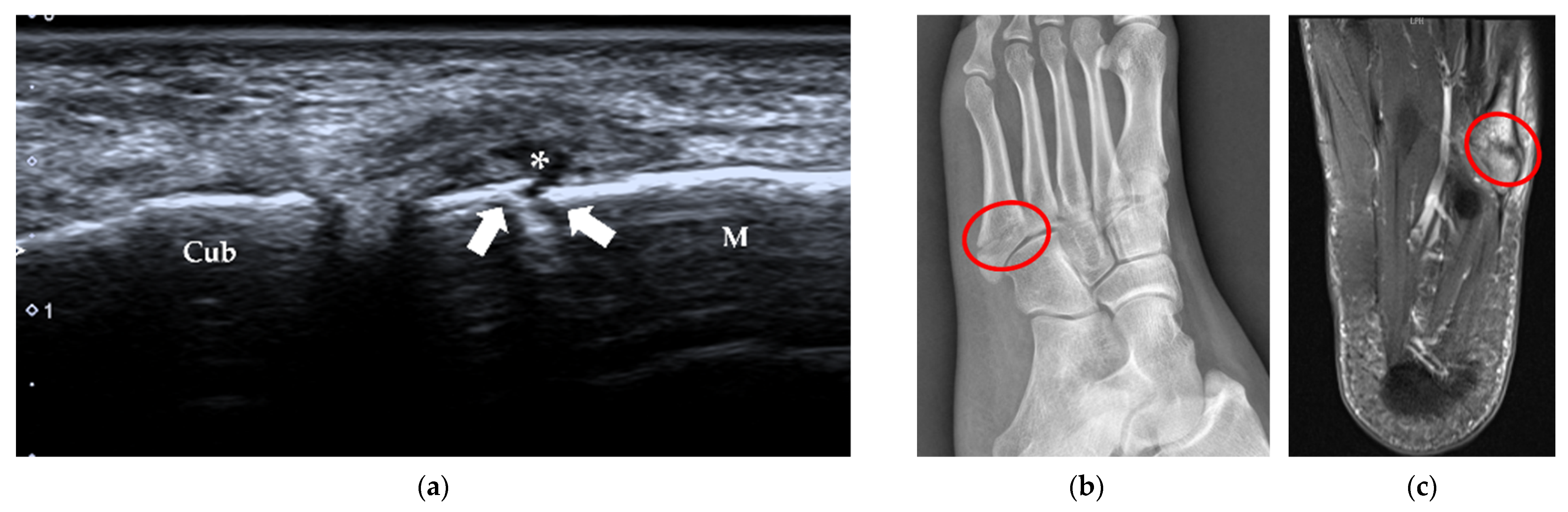 Diagnostics 12 01541 g014