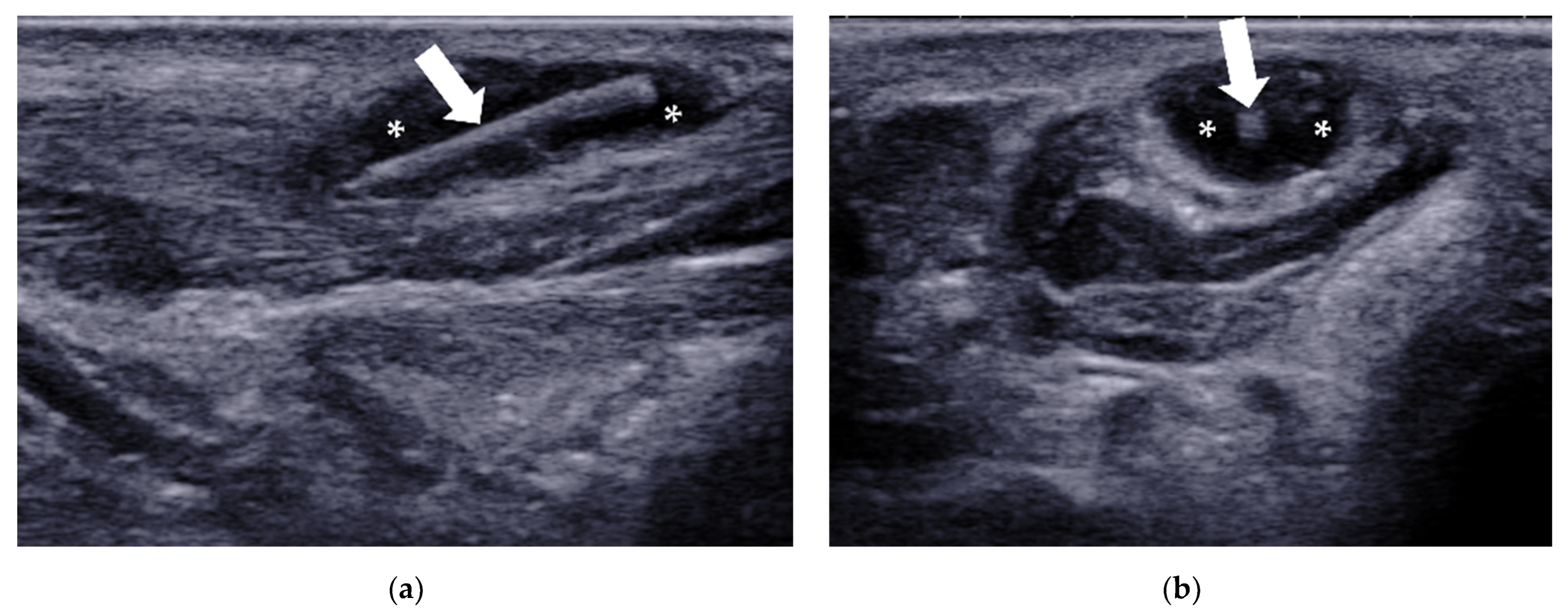 Diagnostics 12 01541 g015