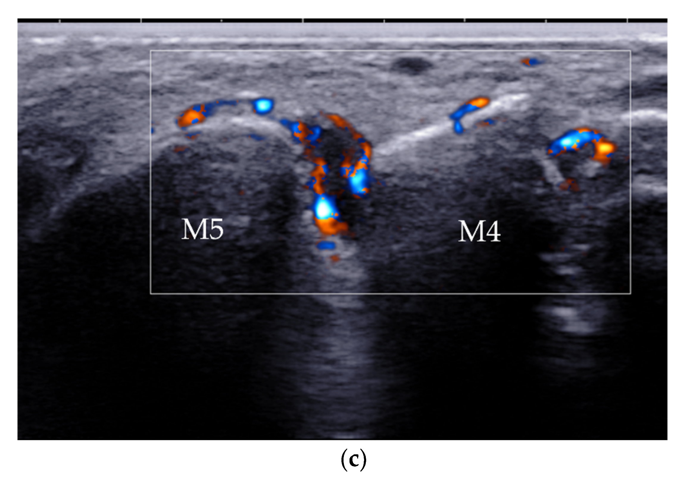 Diagnostics 12 01541 g020b