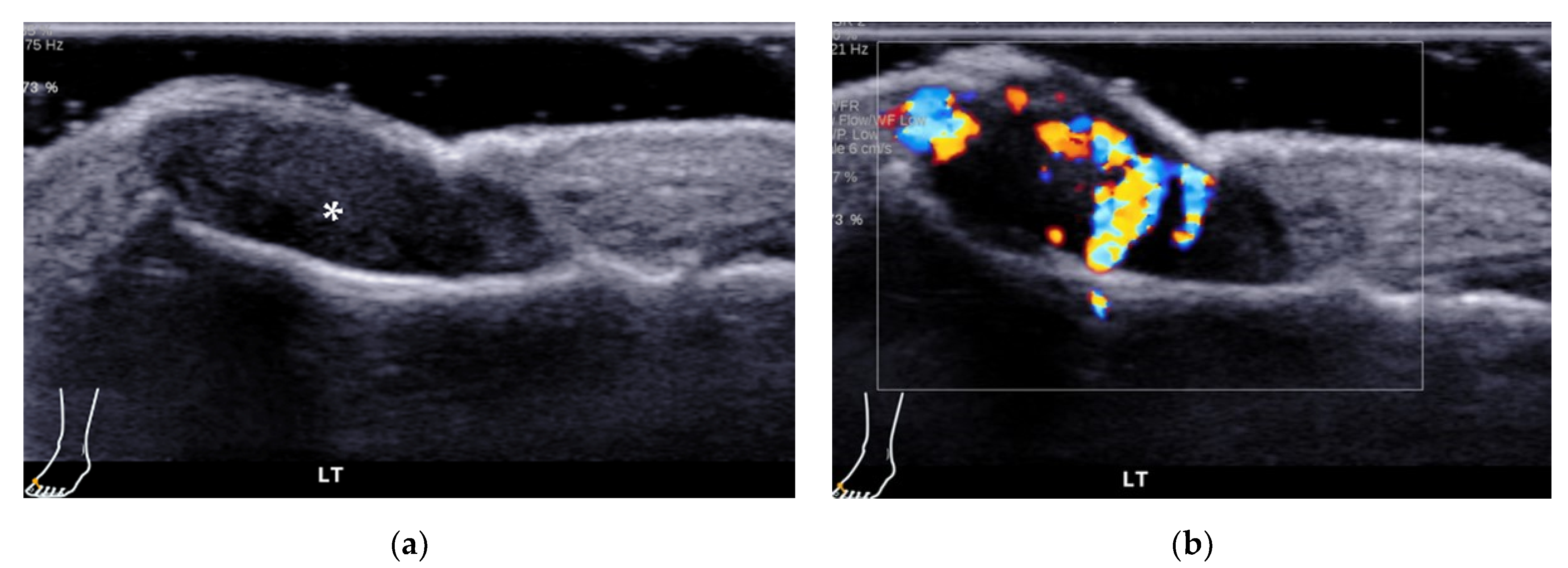 Diagnostics 12 01541 g022