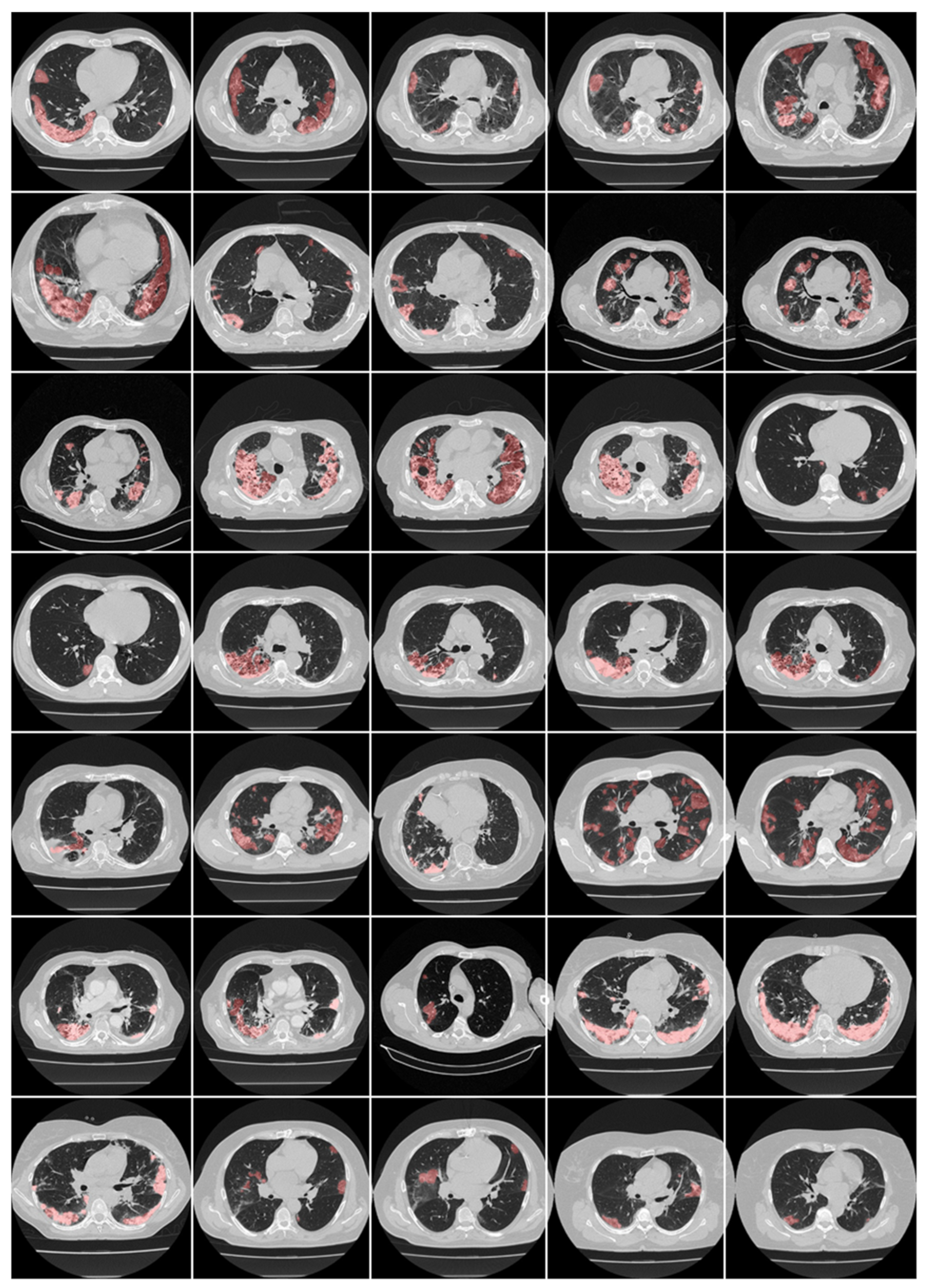 Diagnostics 12 01543 g013