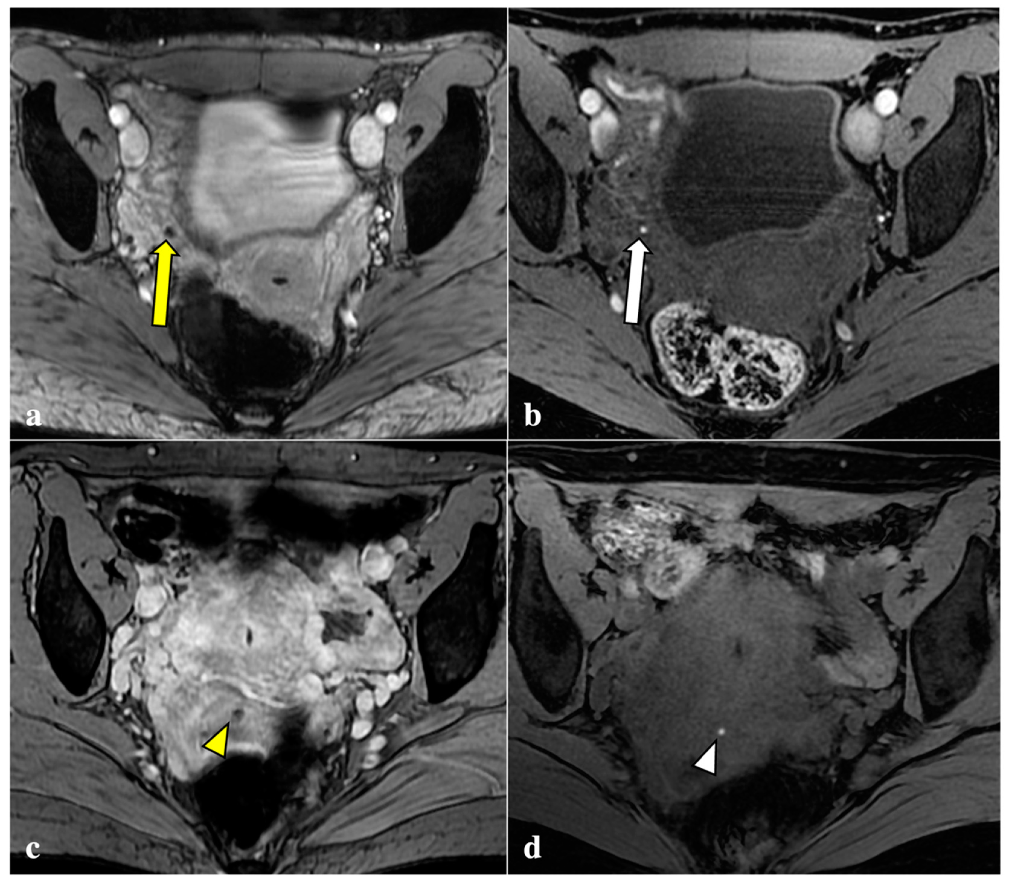 Diagnostics 12 01545 g001 550